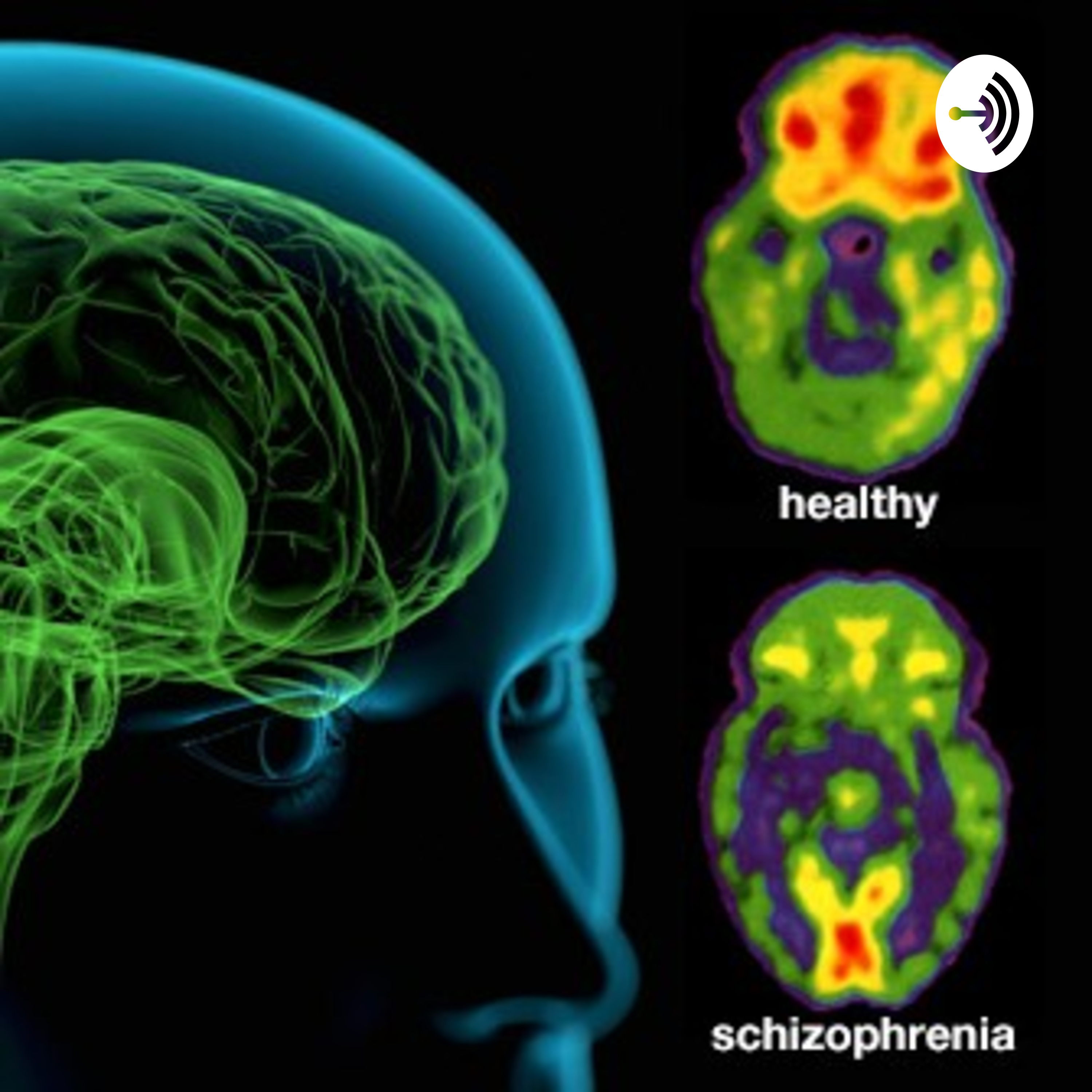 LivingAndThrivingWithSchizophrenia