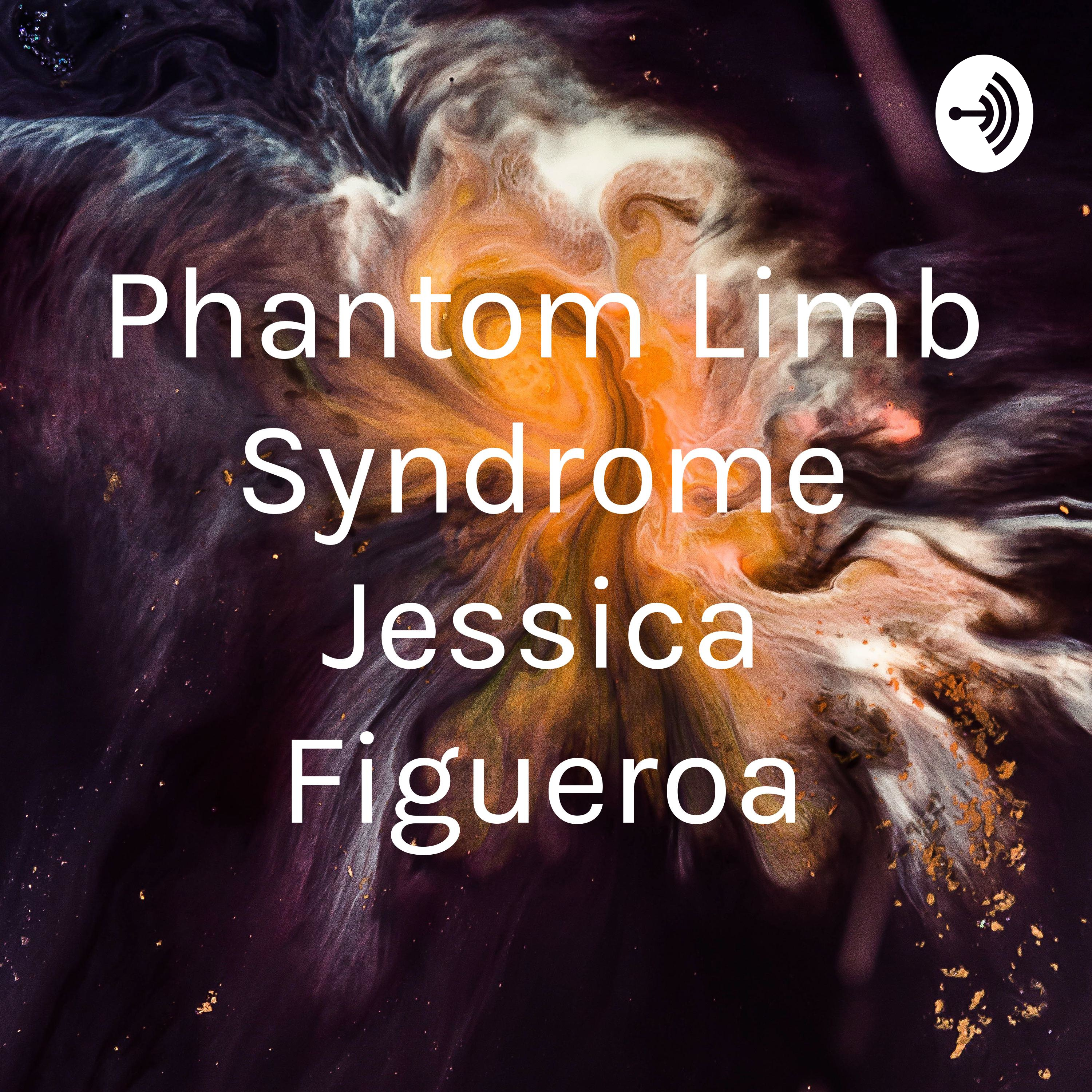 Phantom Limb Syndrome Jessica Figueroa