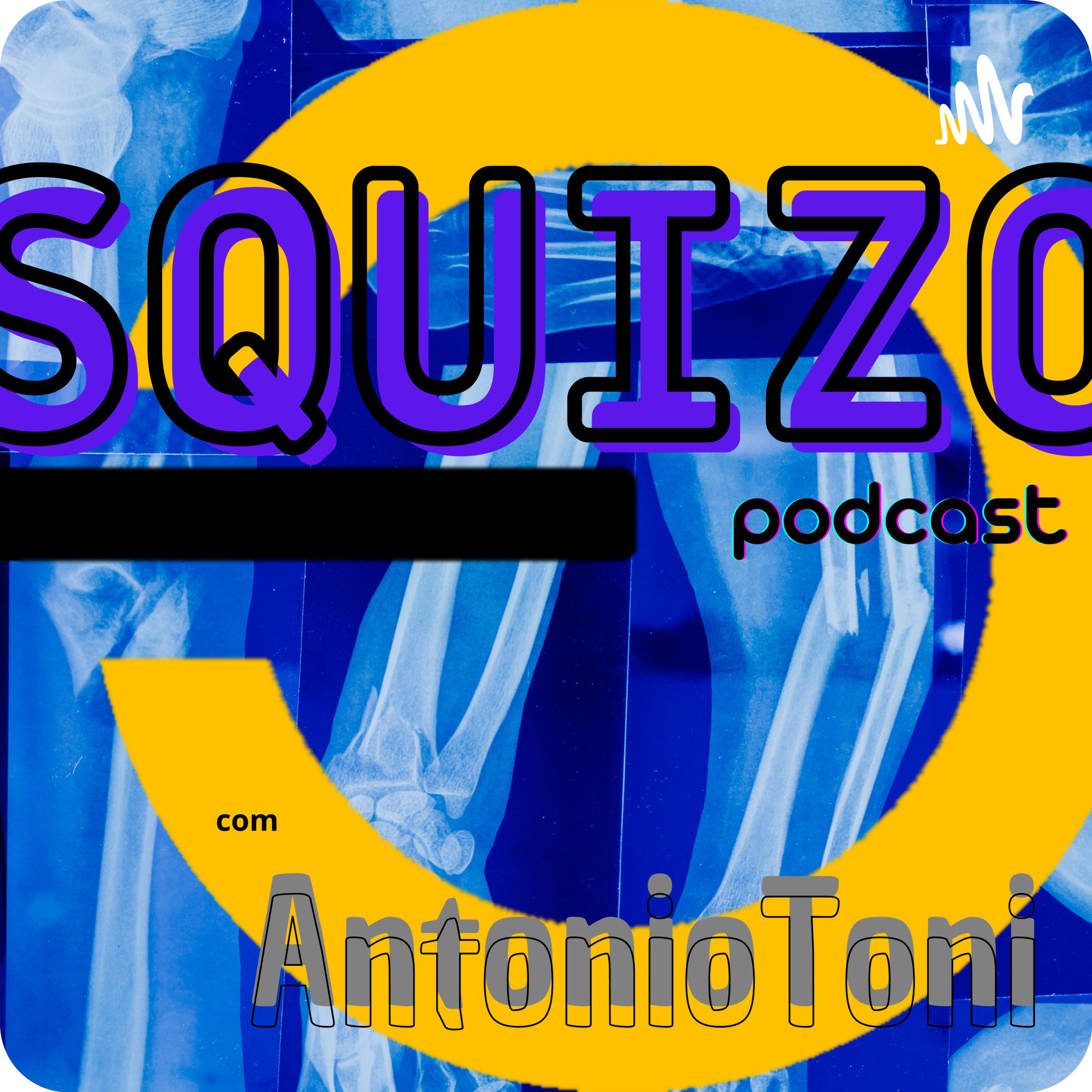Squizo