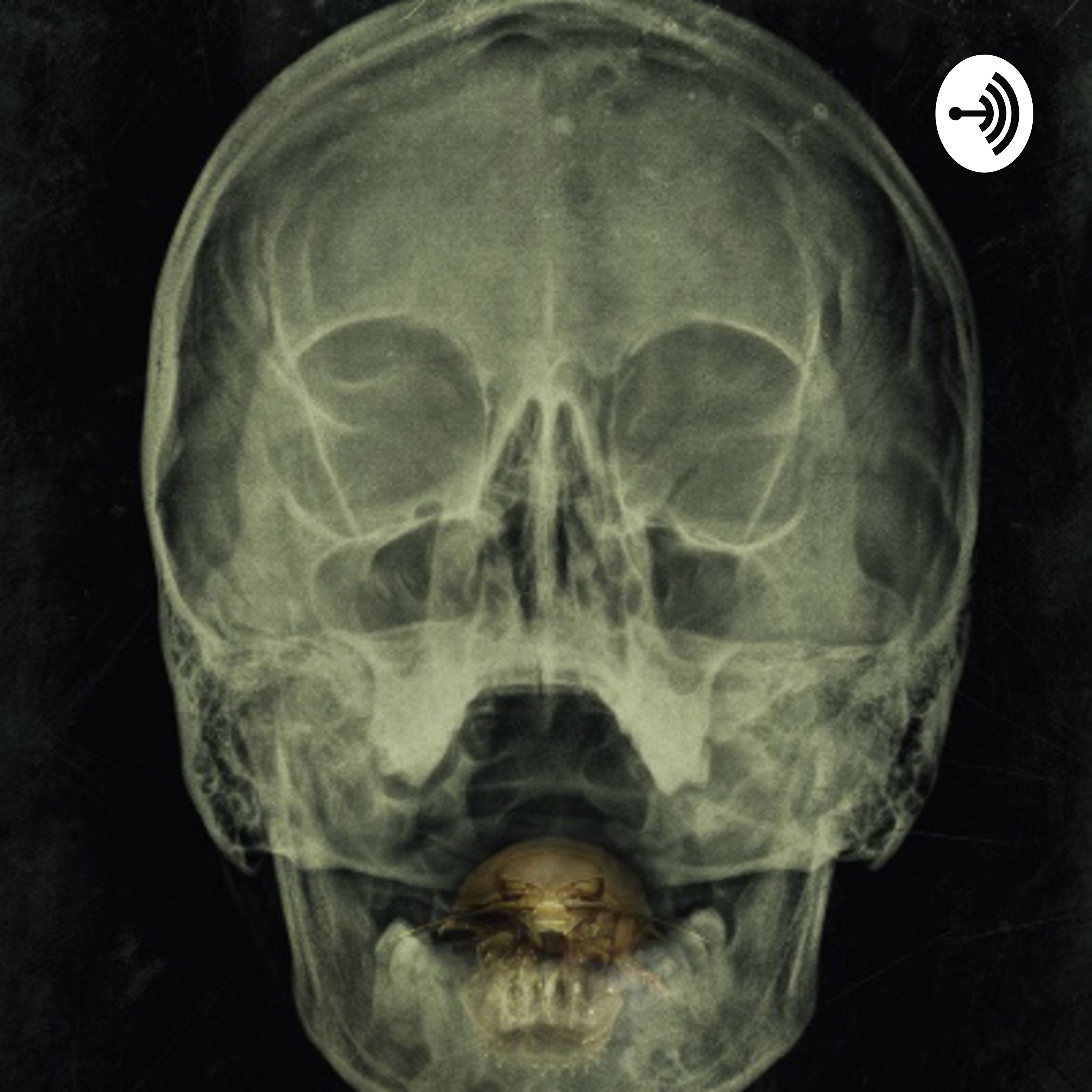Breakdowns & Blackouts