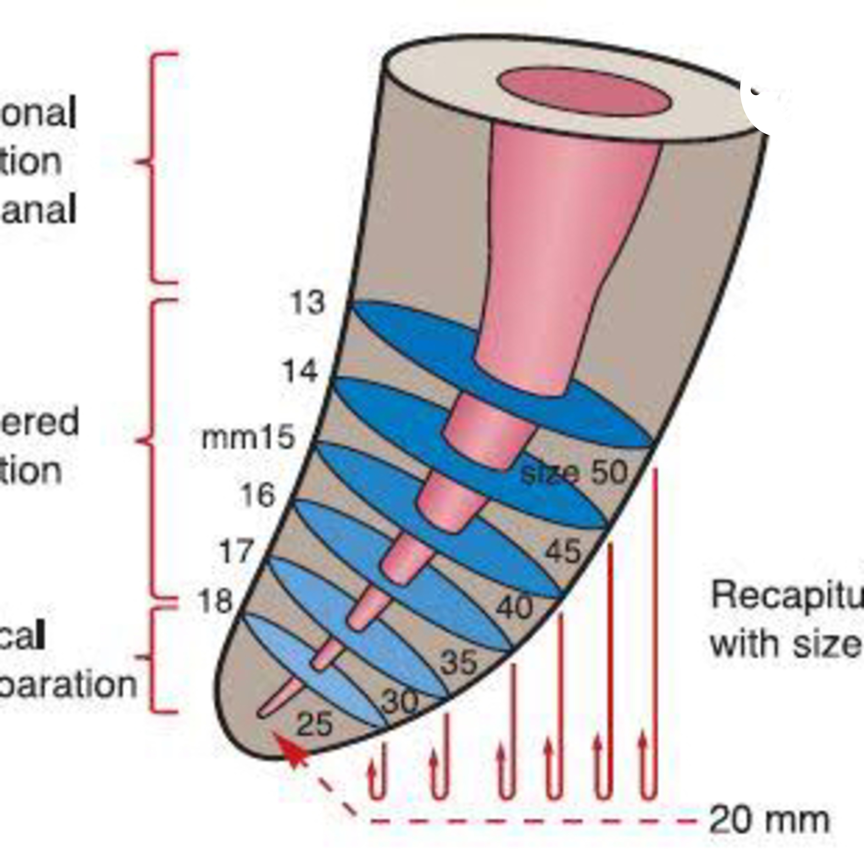 Step Back y Crown Down