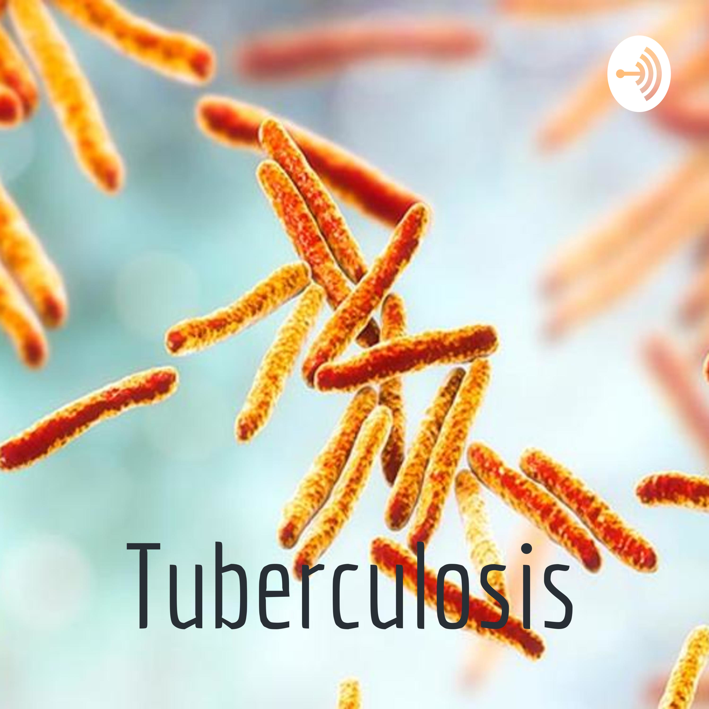 Tuberculosis