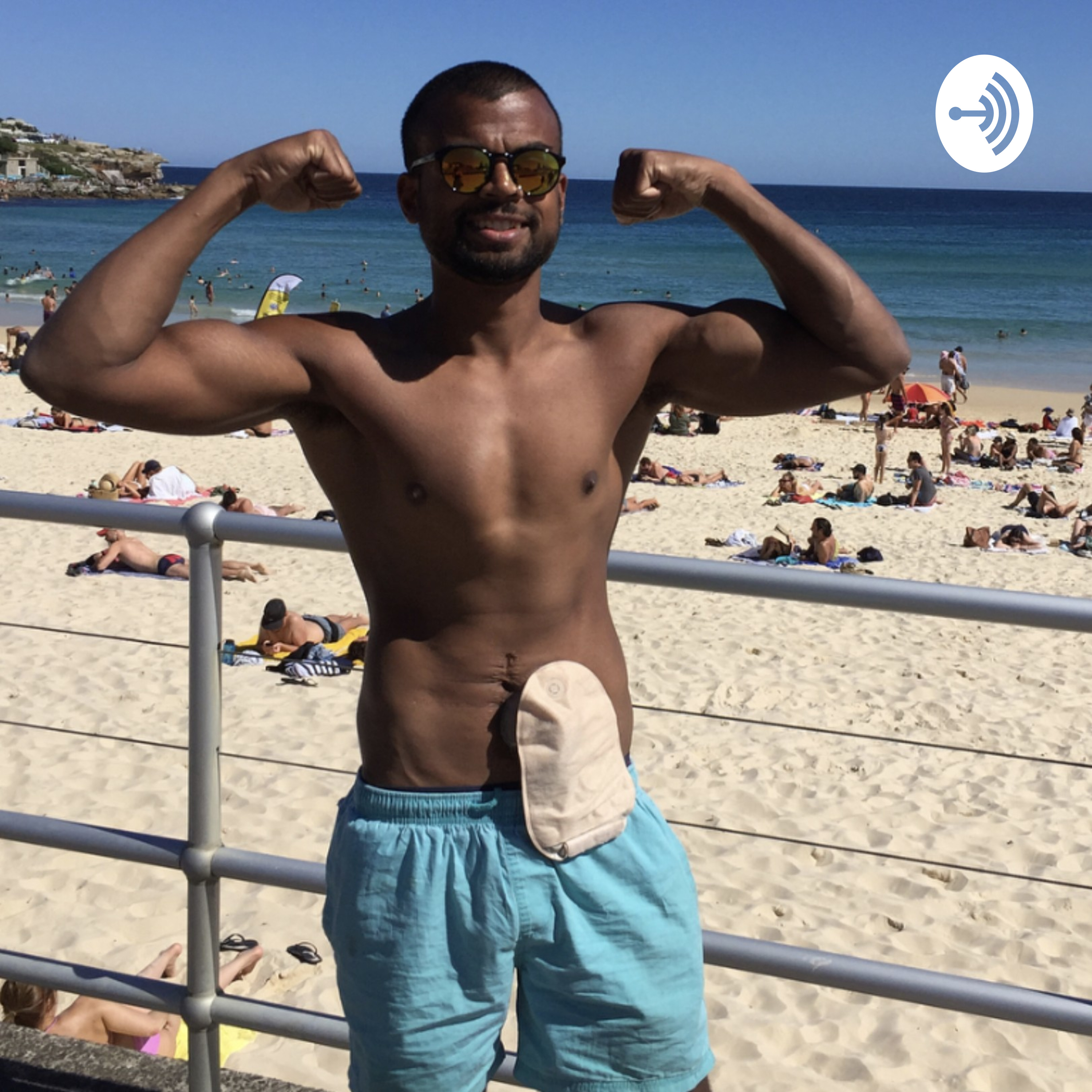 Crohn's and Ostomy Confidence Project