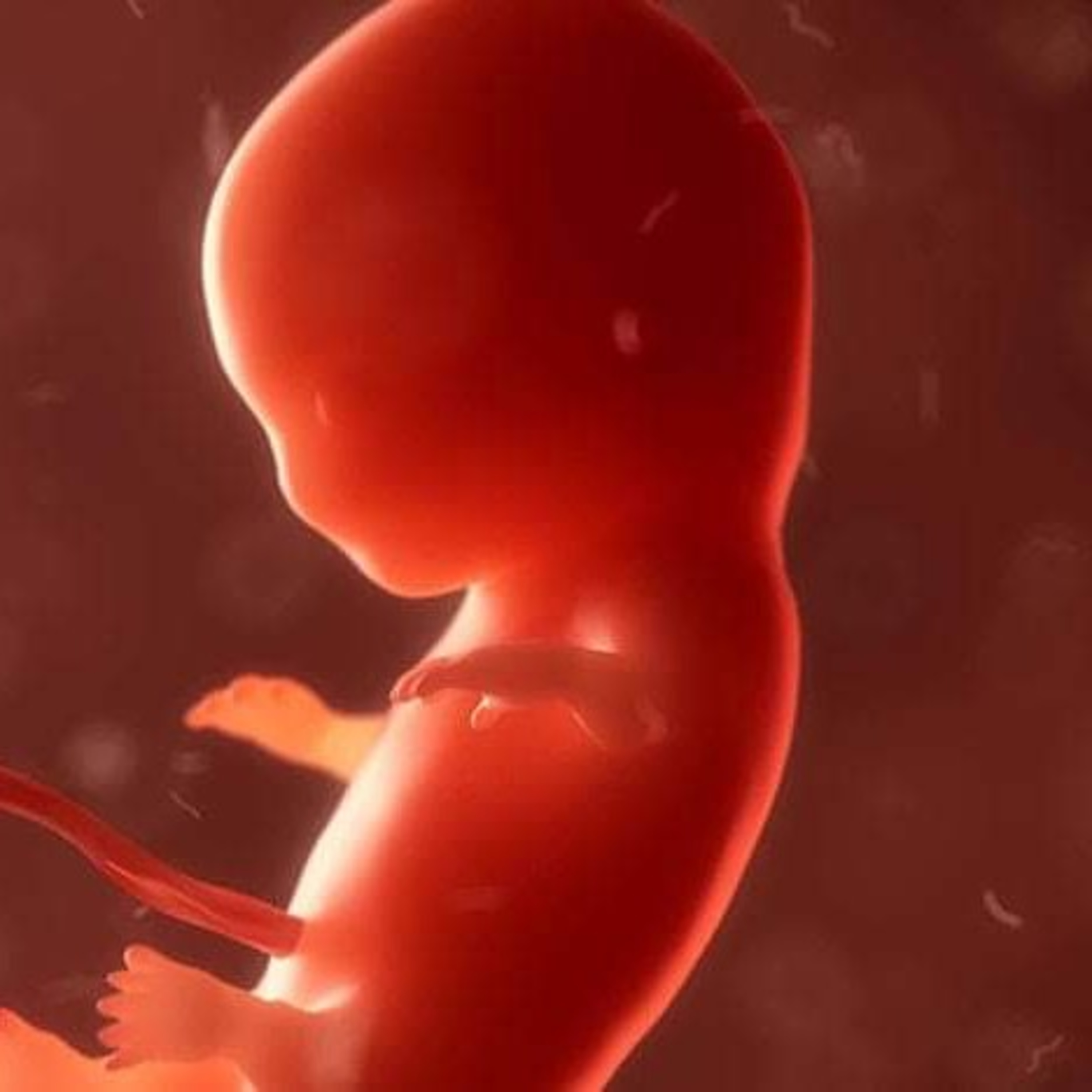 Aborto  episode artwork