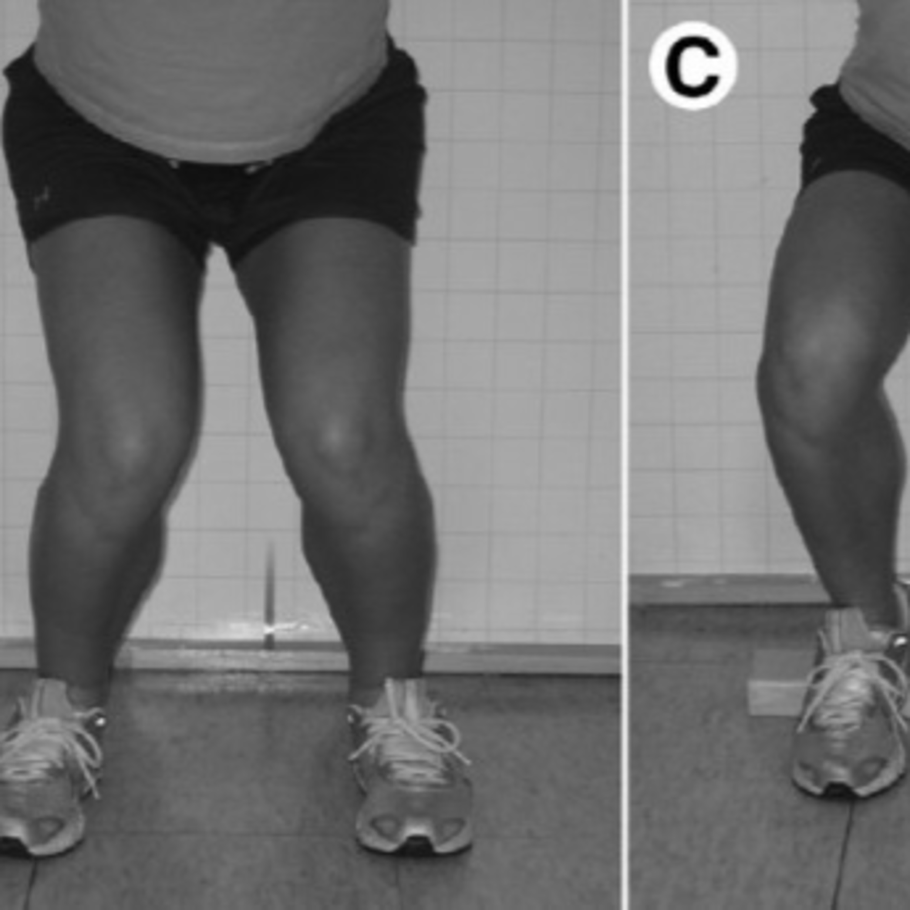 CI: The Importance of External Rotation