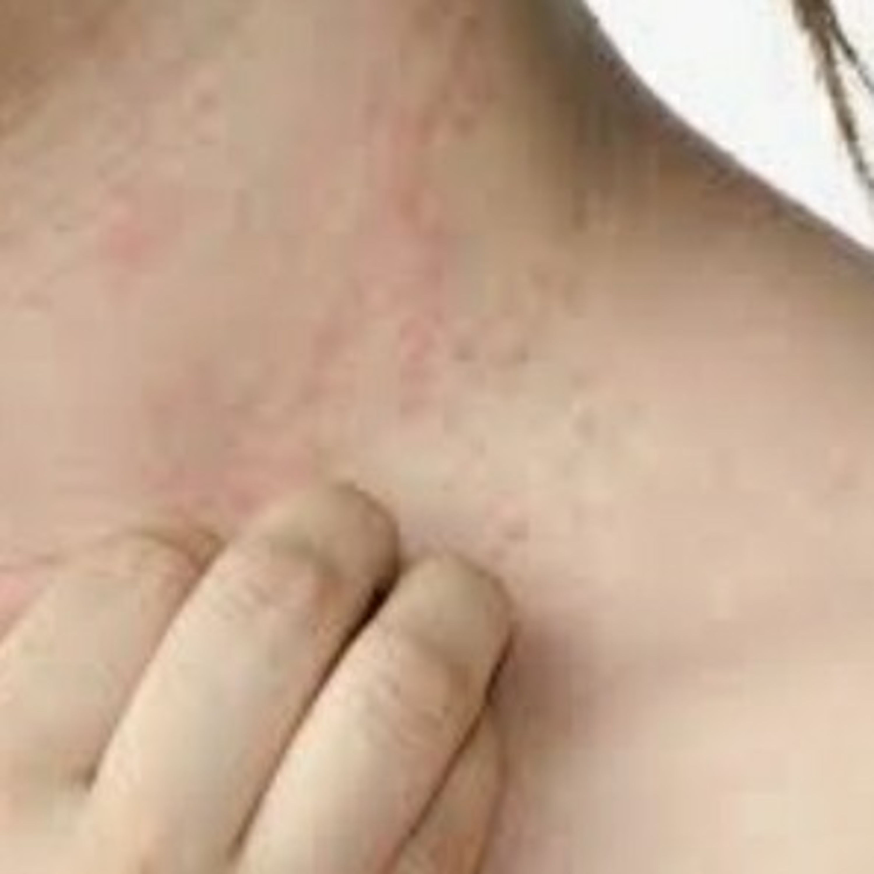 Dermatitis,Hemorroides y Hematomas episode artwork