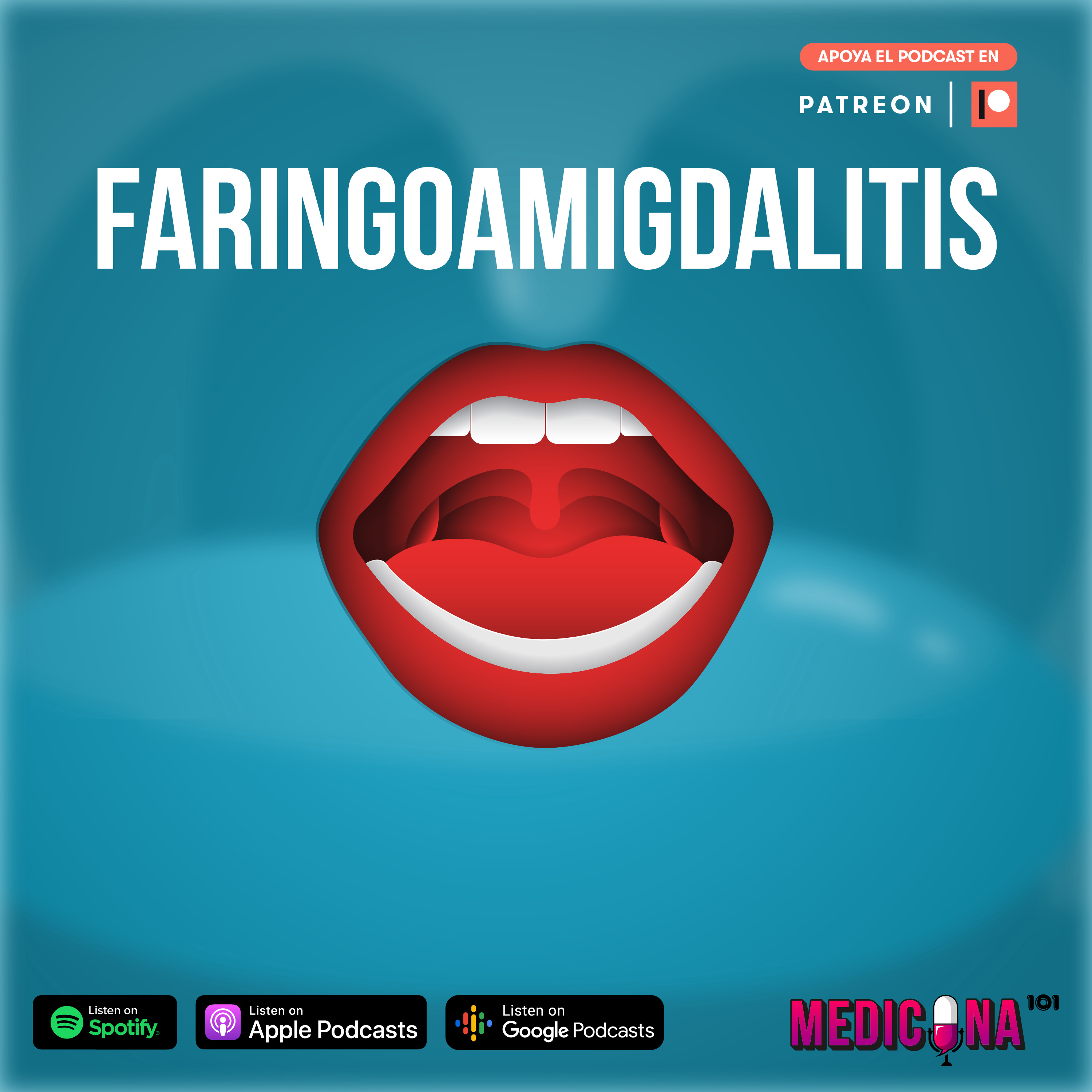 Faringoamigdalitis