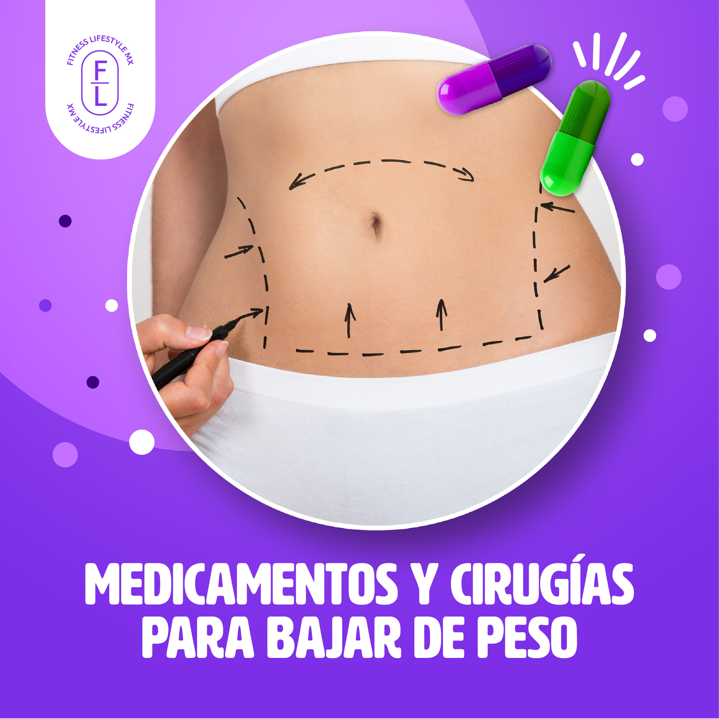 Ep. 9 Medicamentos y cirugías para bajar de peso