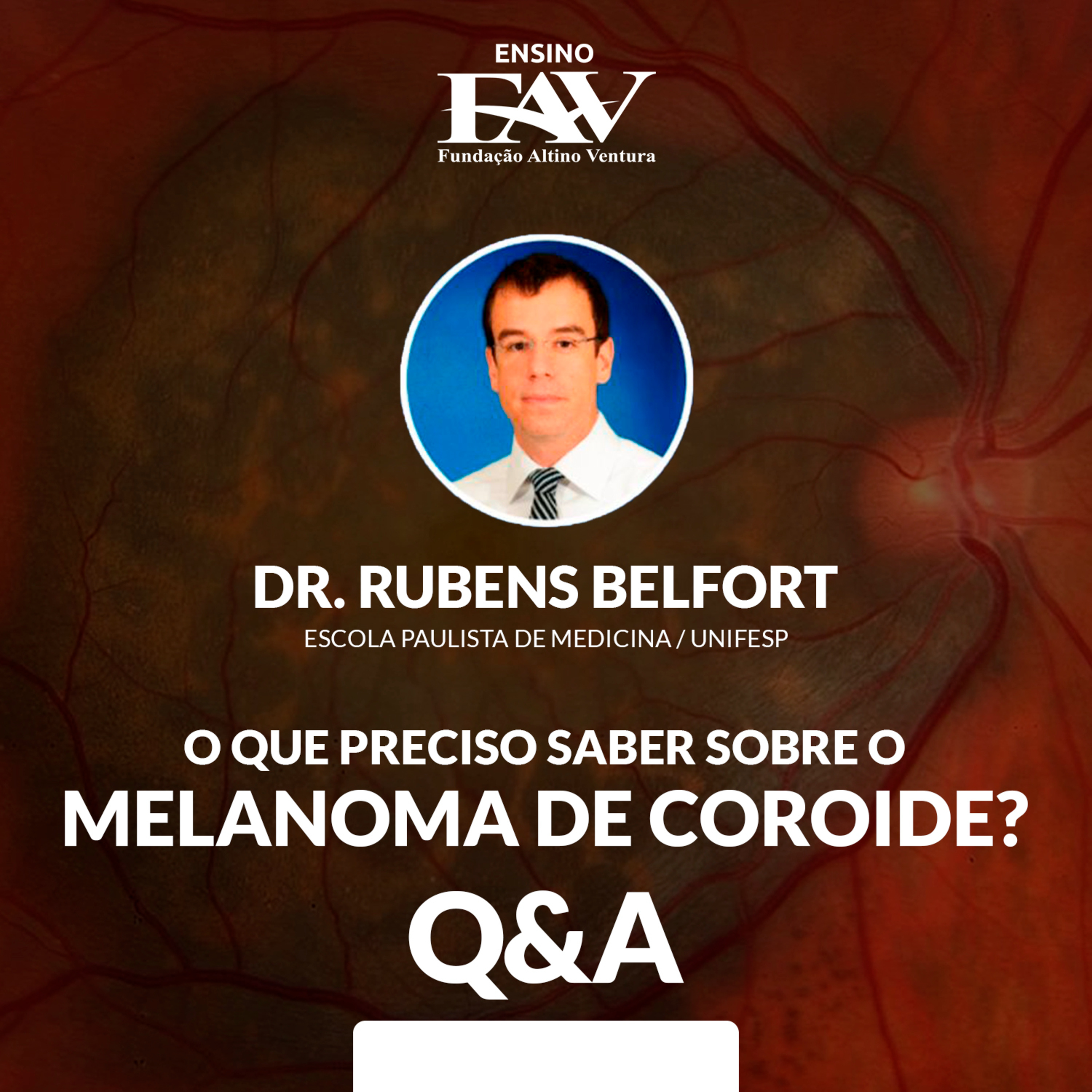 FAVCAST OFTALMOLOGIA | Fundação Altino Ventura