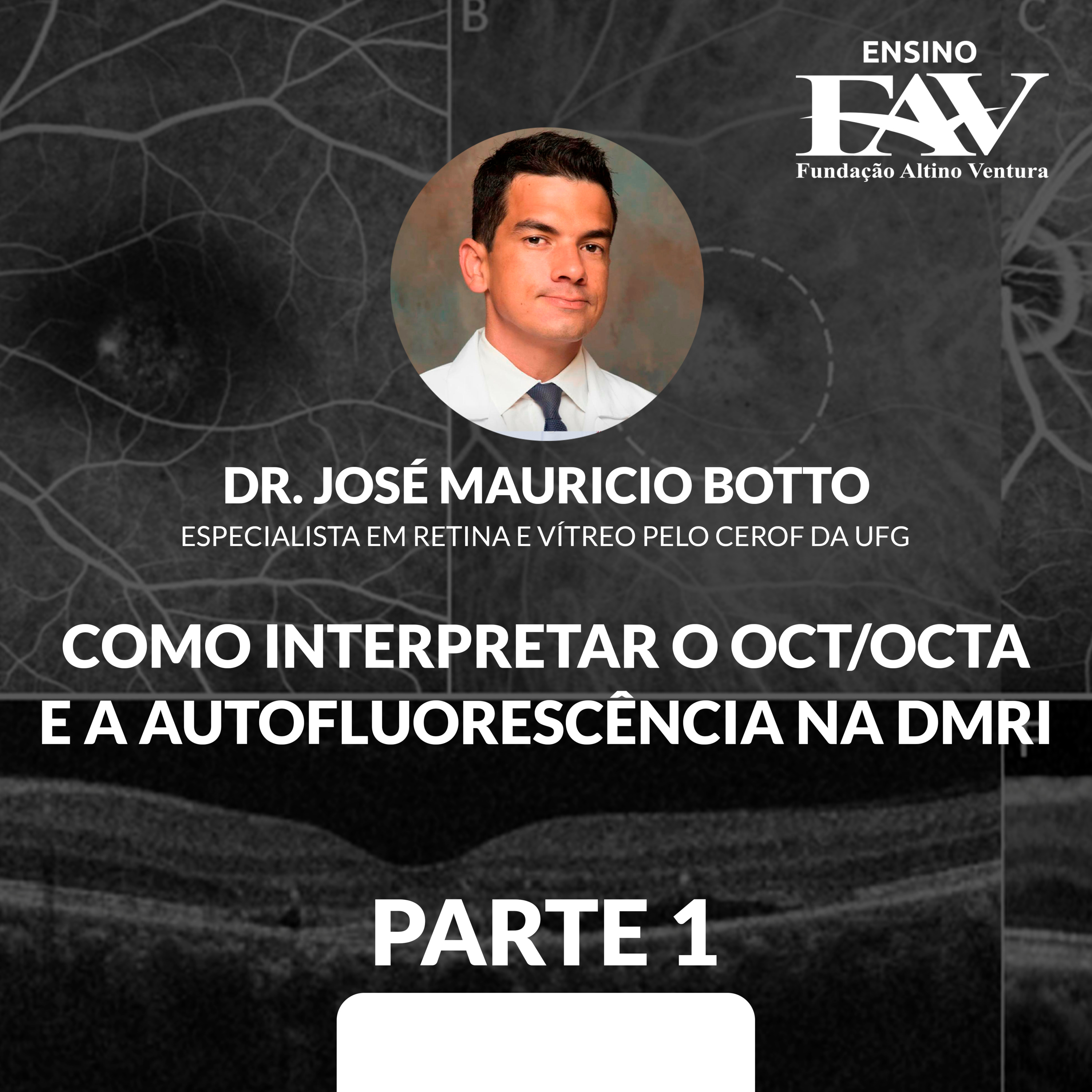 FAVCAST OFTALMOLOGIA | Fundação Altino Ventura