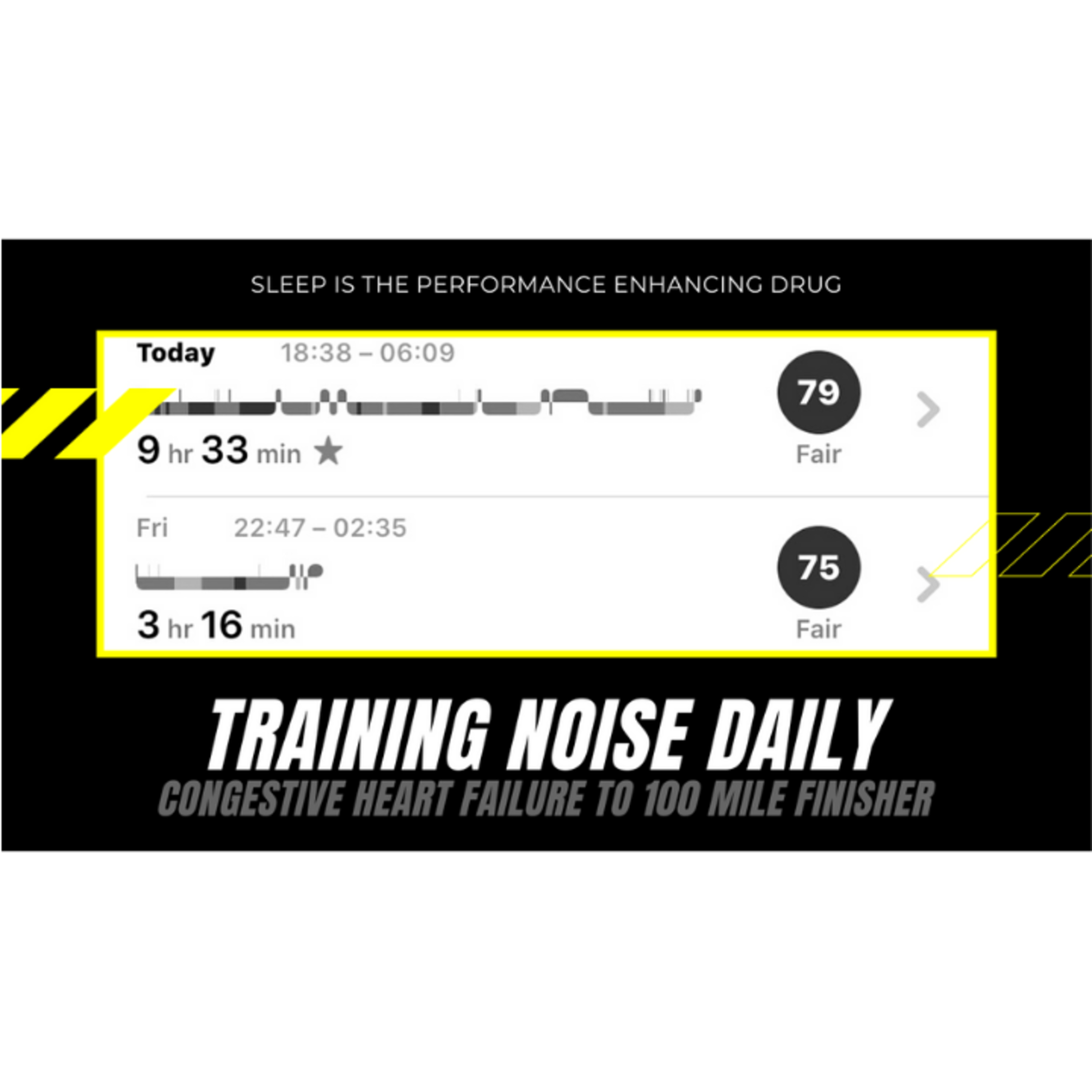 637. 9 hours of SLEEP is a PB for Coach Noise | Training Noise Daily episode artwork