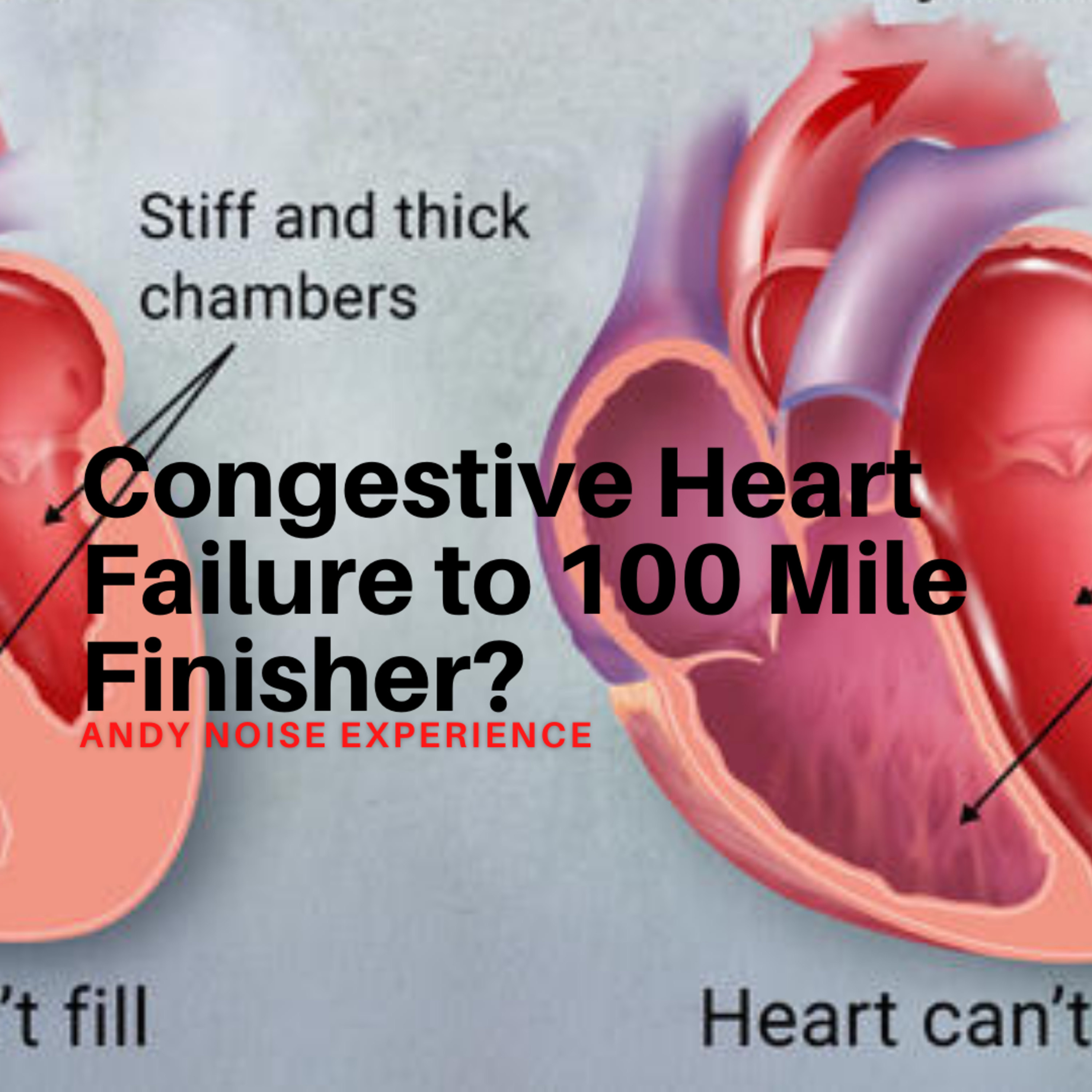 645. Congestive Heart Failure to Hundred Mile Finisher? Race in 4 Days! | Andy Noise Experience episode artwork