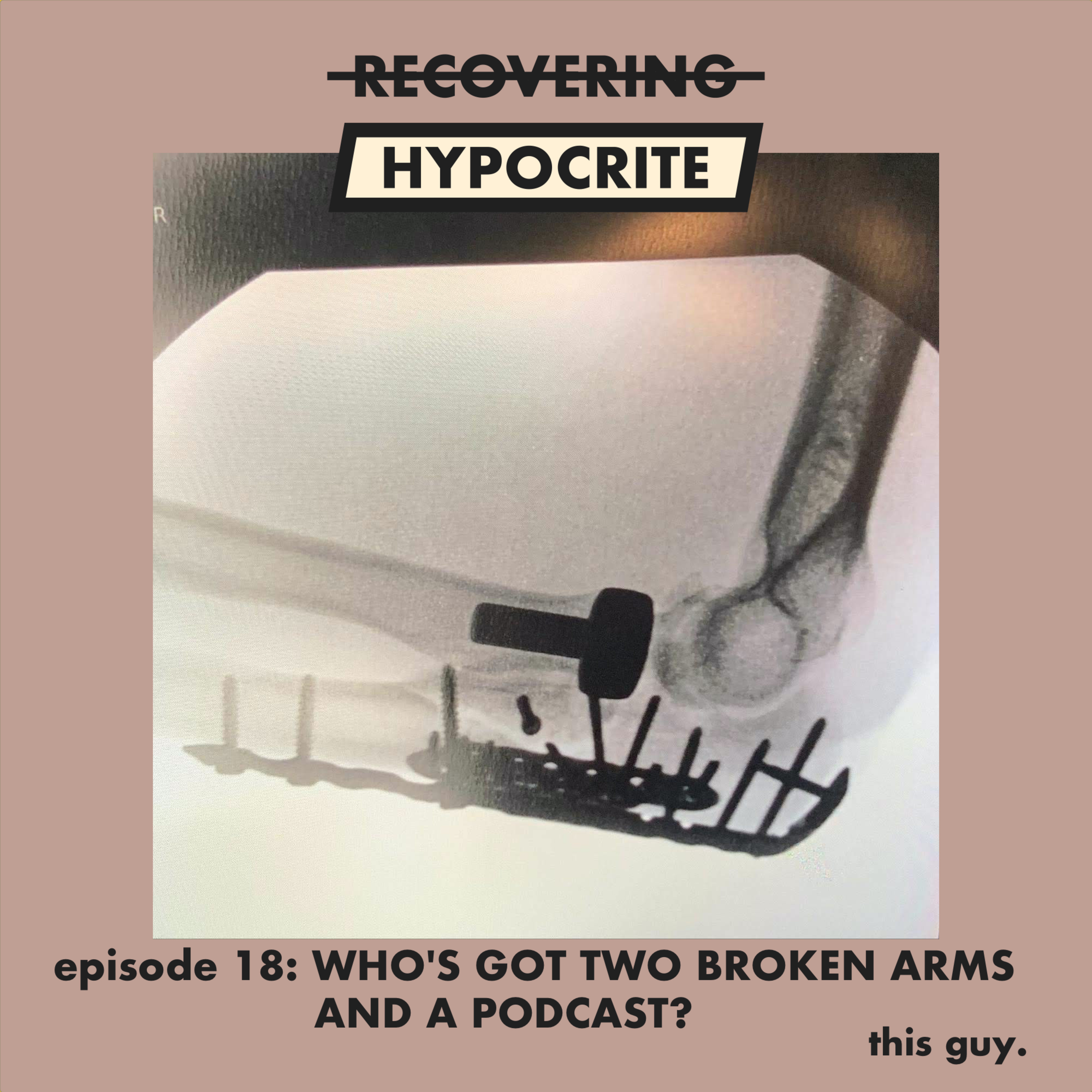 Recovering Hypocrite