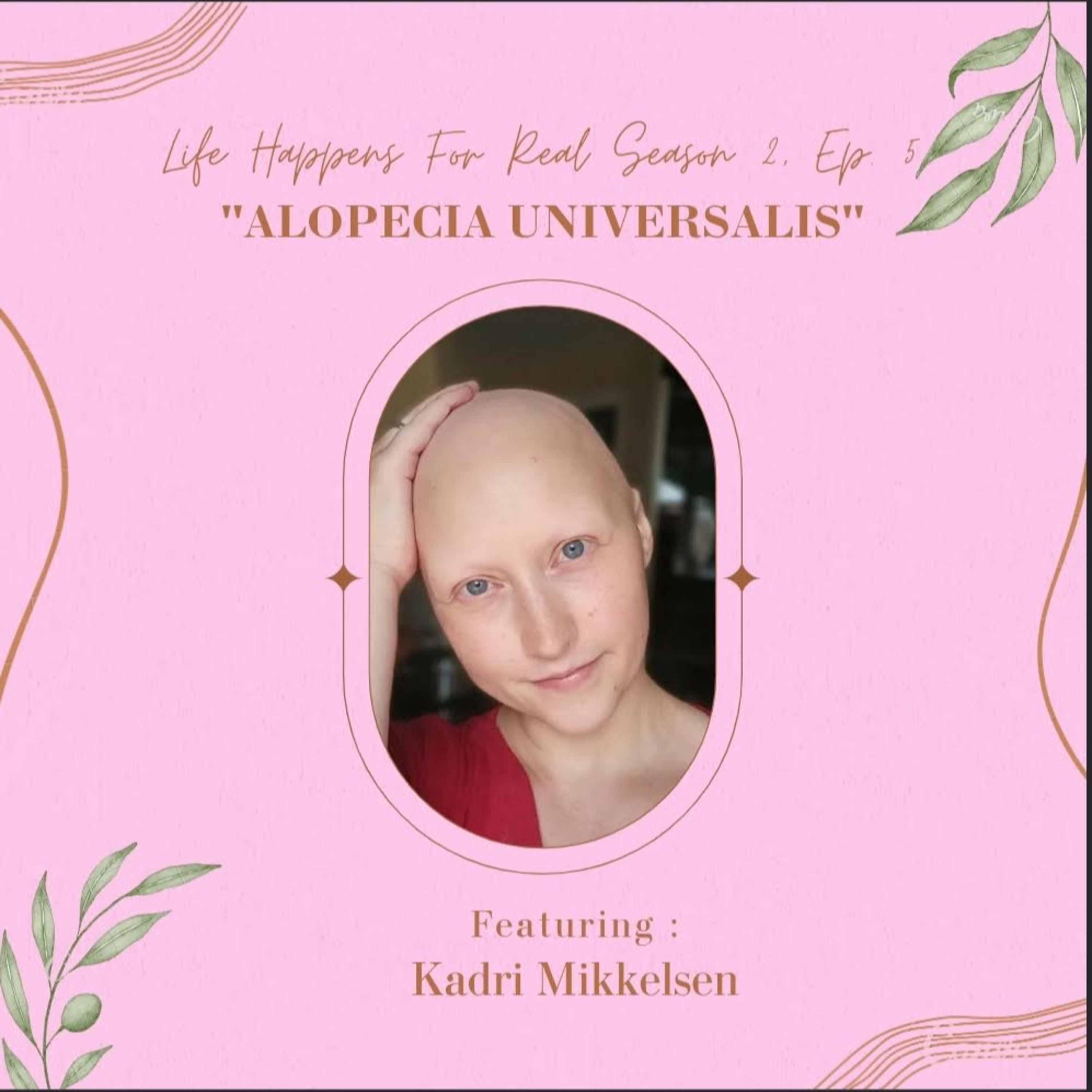 Alopecia Universalis- Complete loss of hair on the scalp and the body.