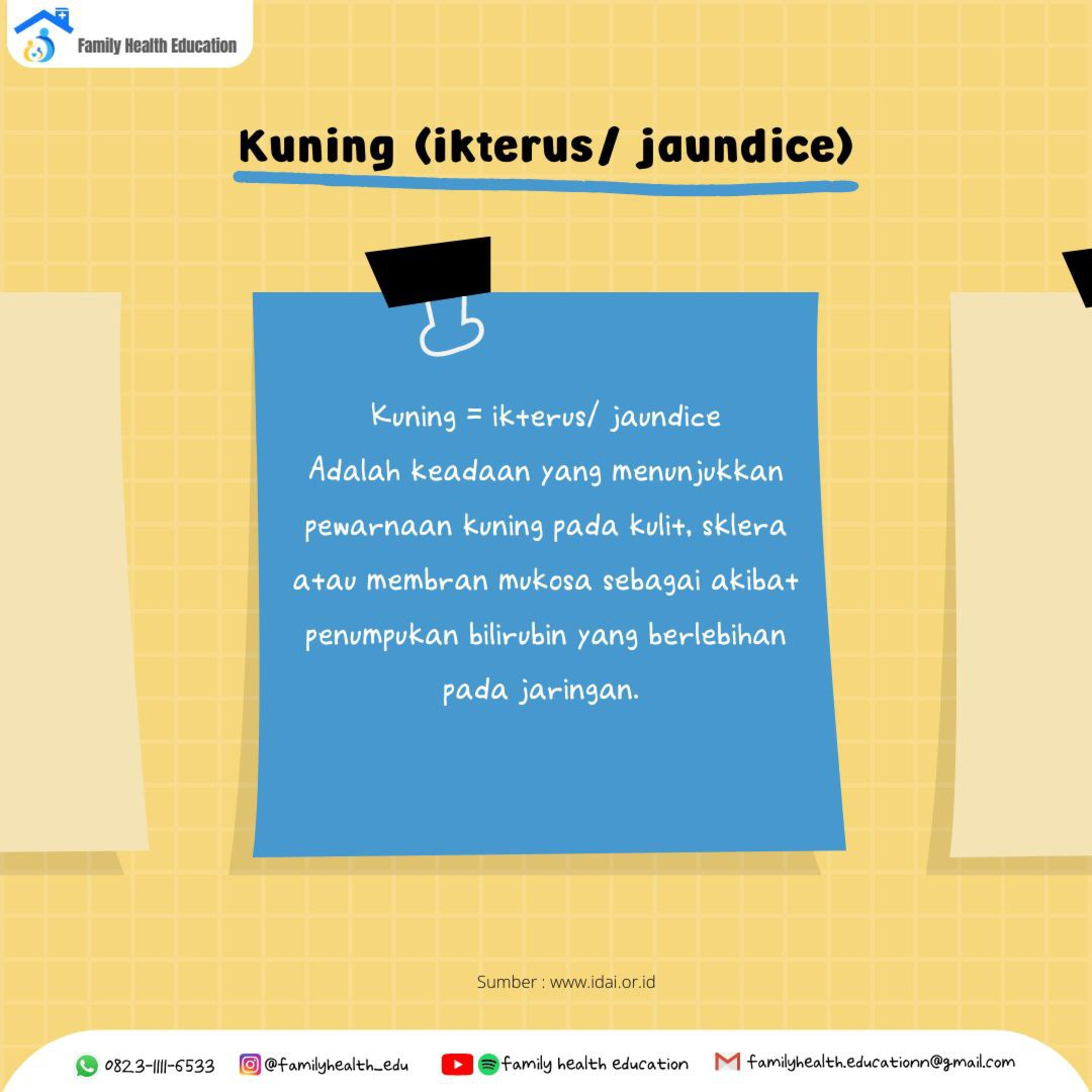 #15.9 Ikterus Pada bayi