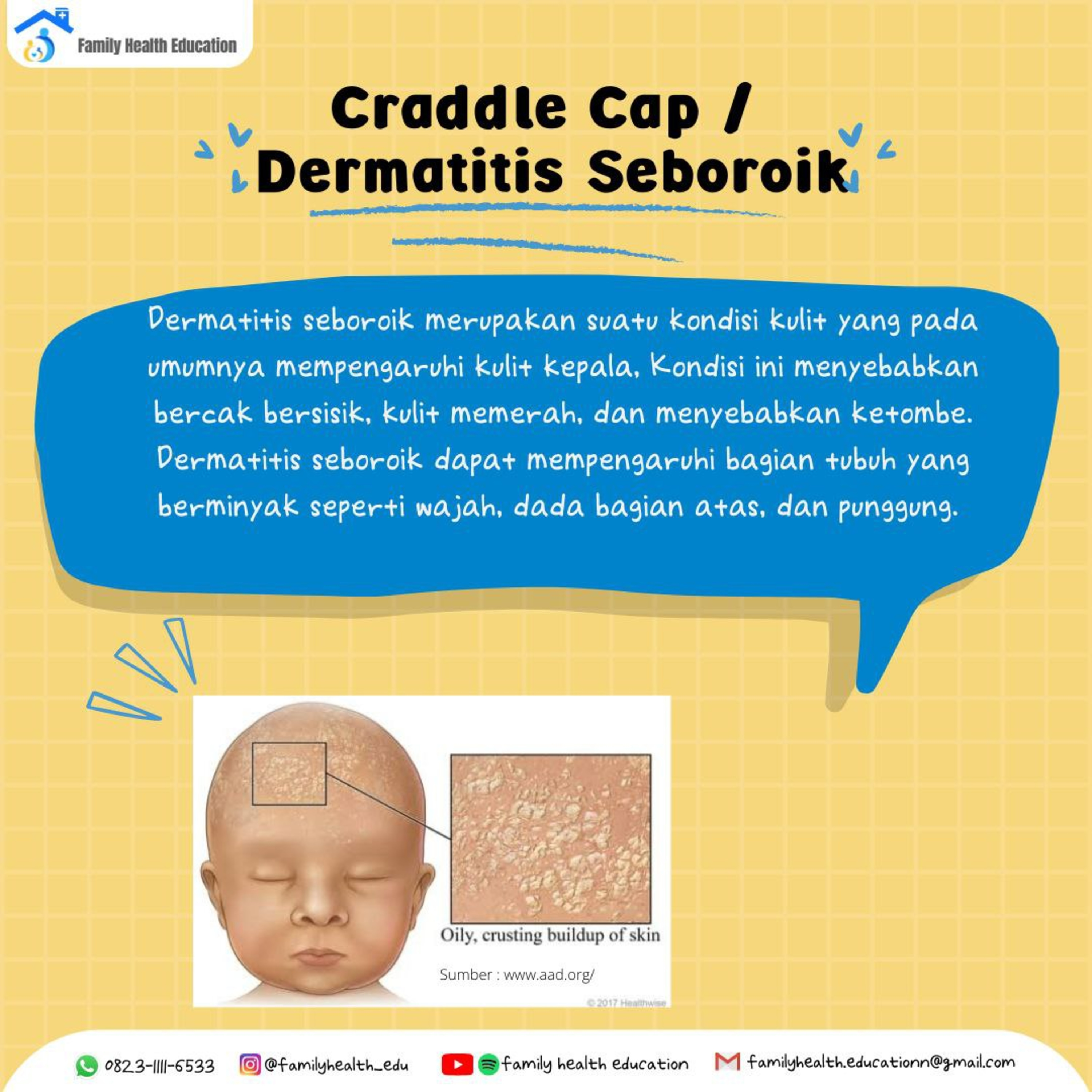 #19.9 Dermatitis Seboroik