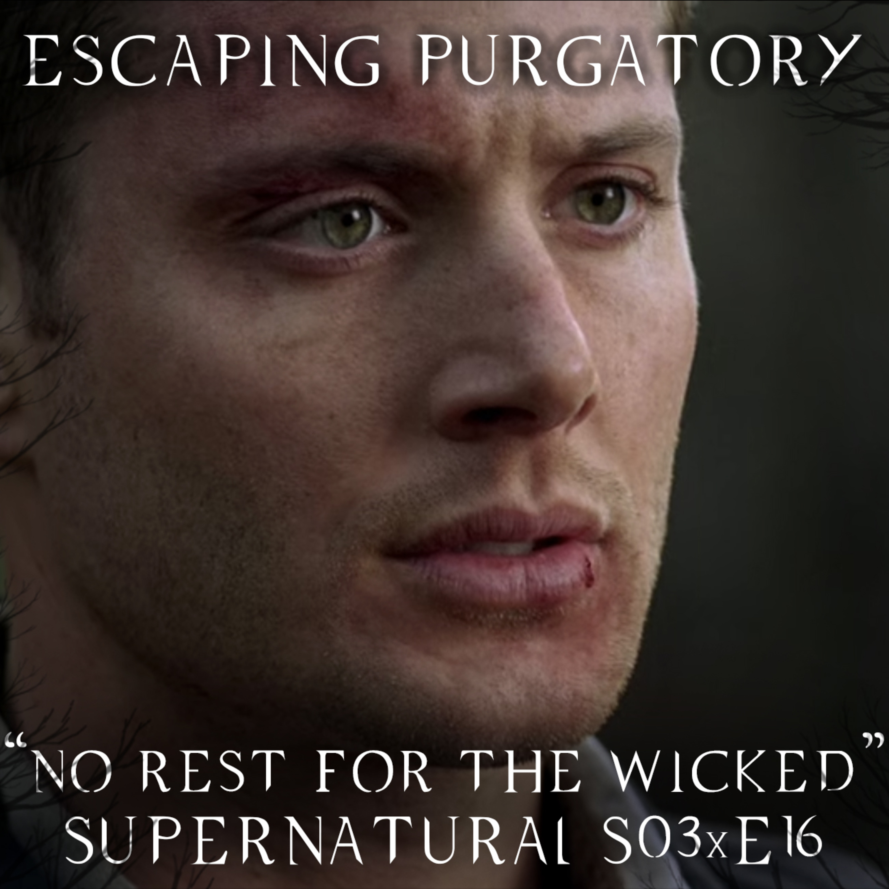 Episode 03:16 - No Rest for the Wicked episode artwork