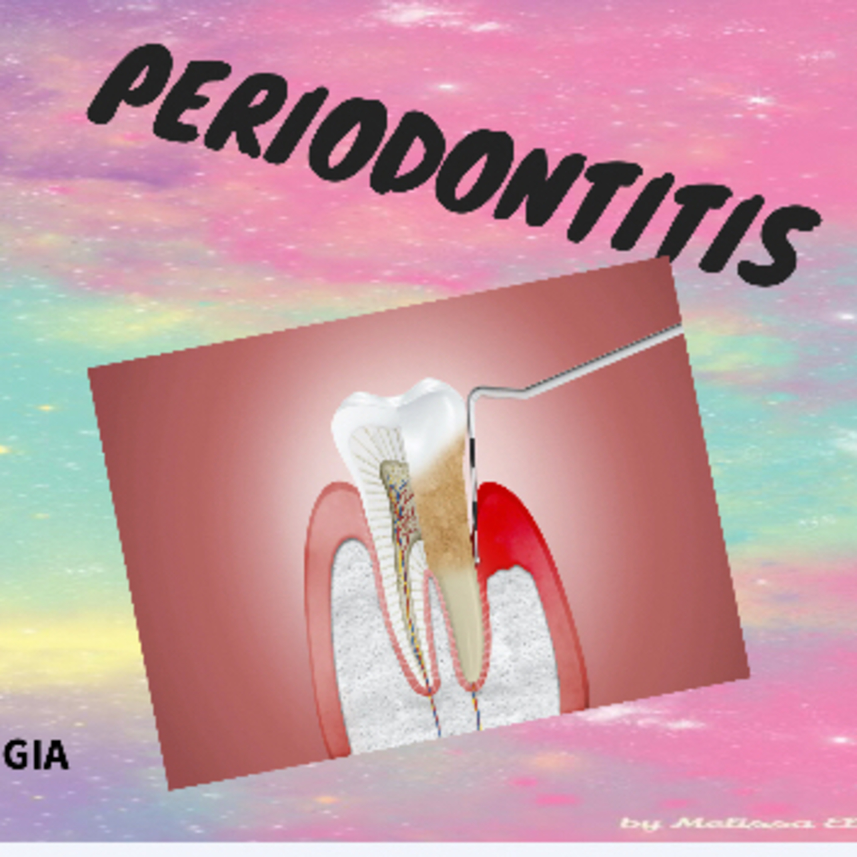 PERIODONTITI episode artwork