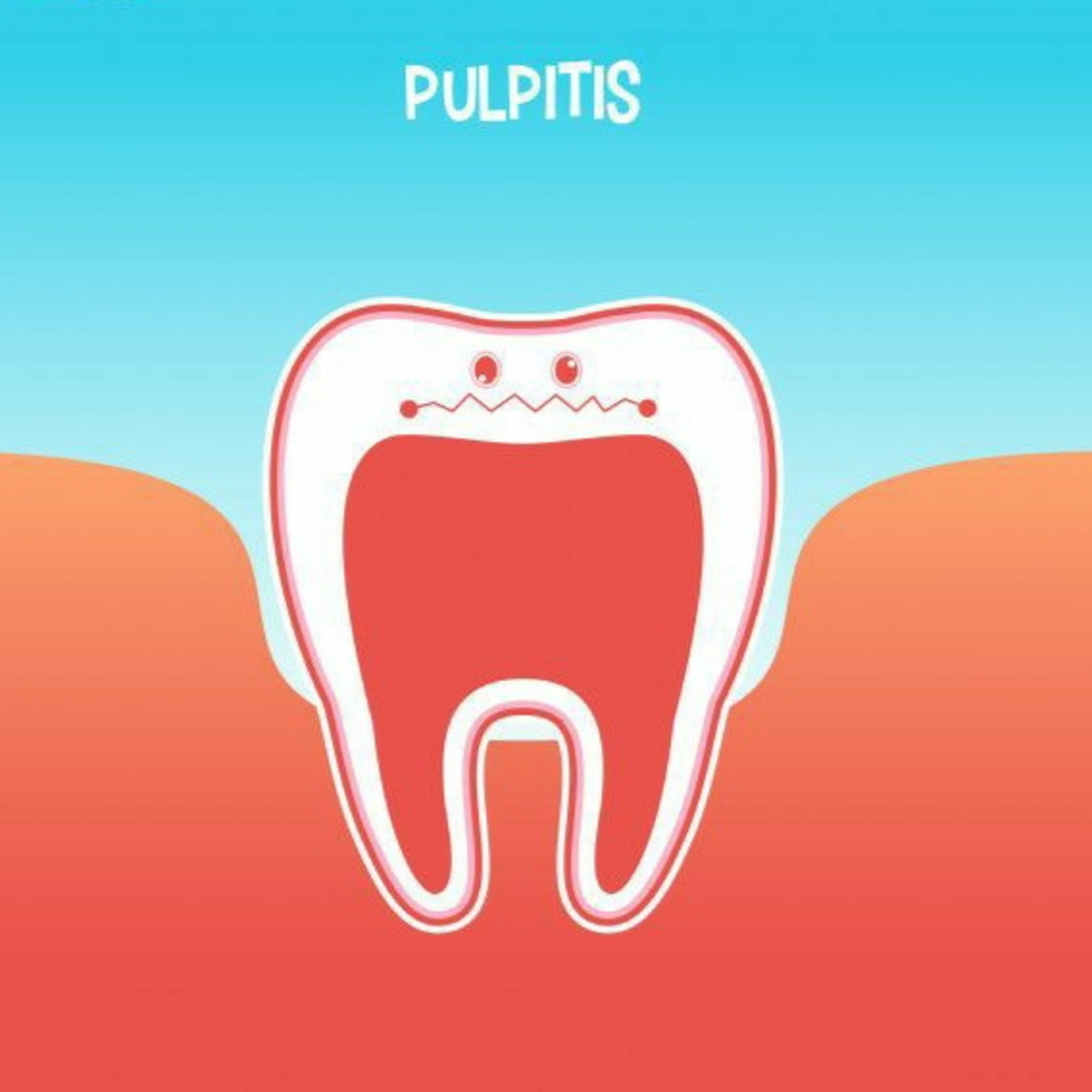 Generalidades de Pulpitis episode artwork