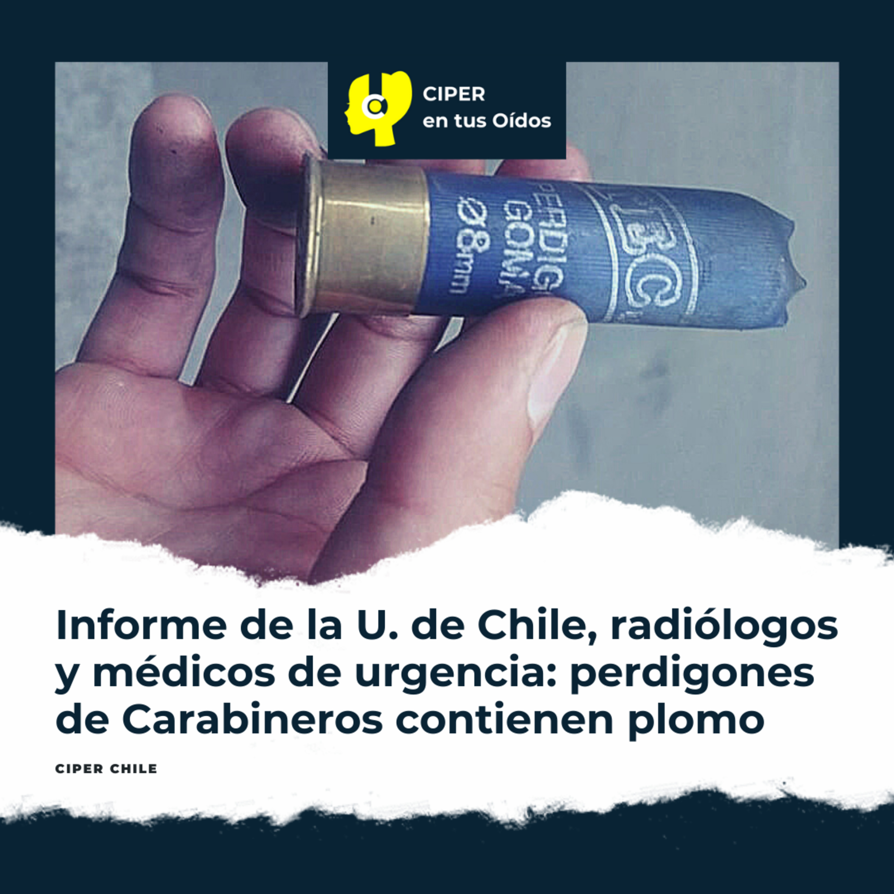 Informe de la U. de Chile, radiólogos y médicos de urgencia: perdigones de Carabineros contienen plomo