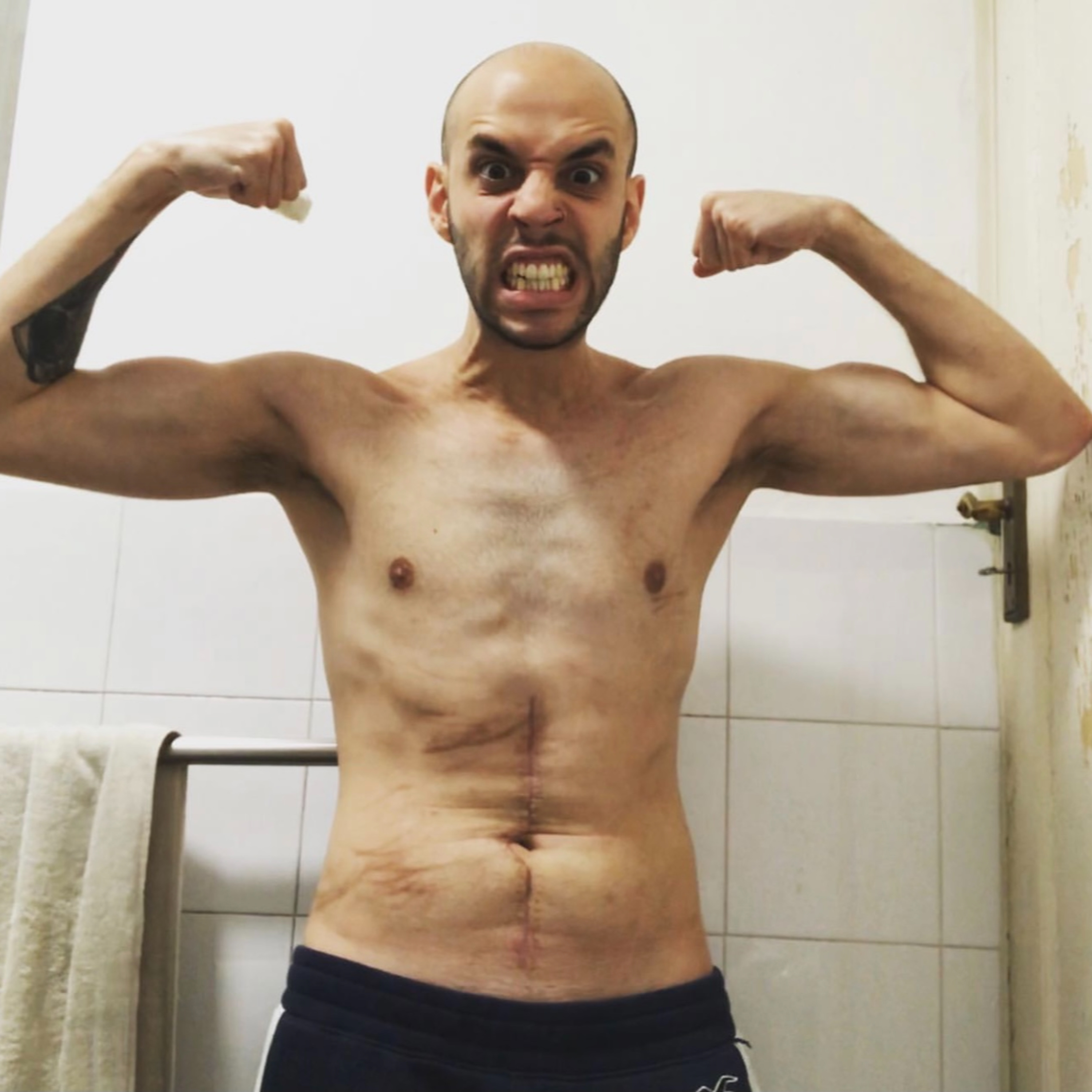 DESCOBRINDO CANCER NA AUSTRALIA com Victor Porto - Casaldcast #12 episode artwork