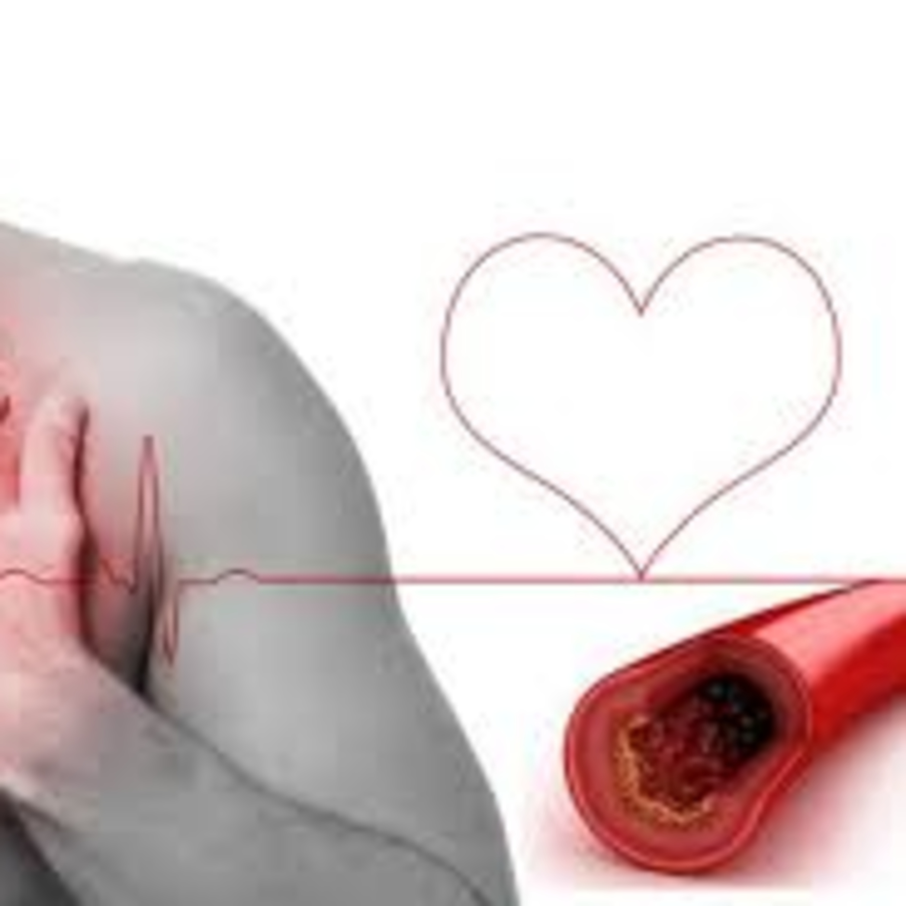 Parte 2 - Colesterol