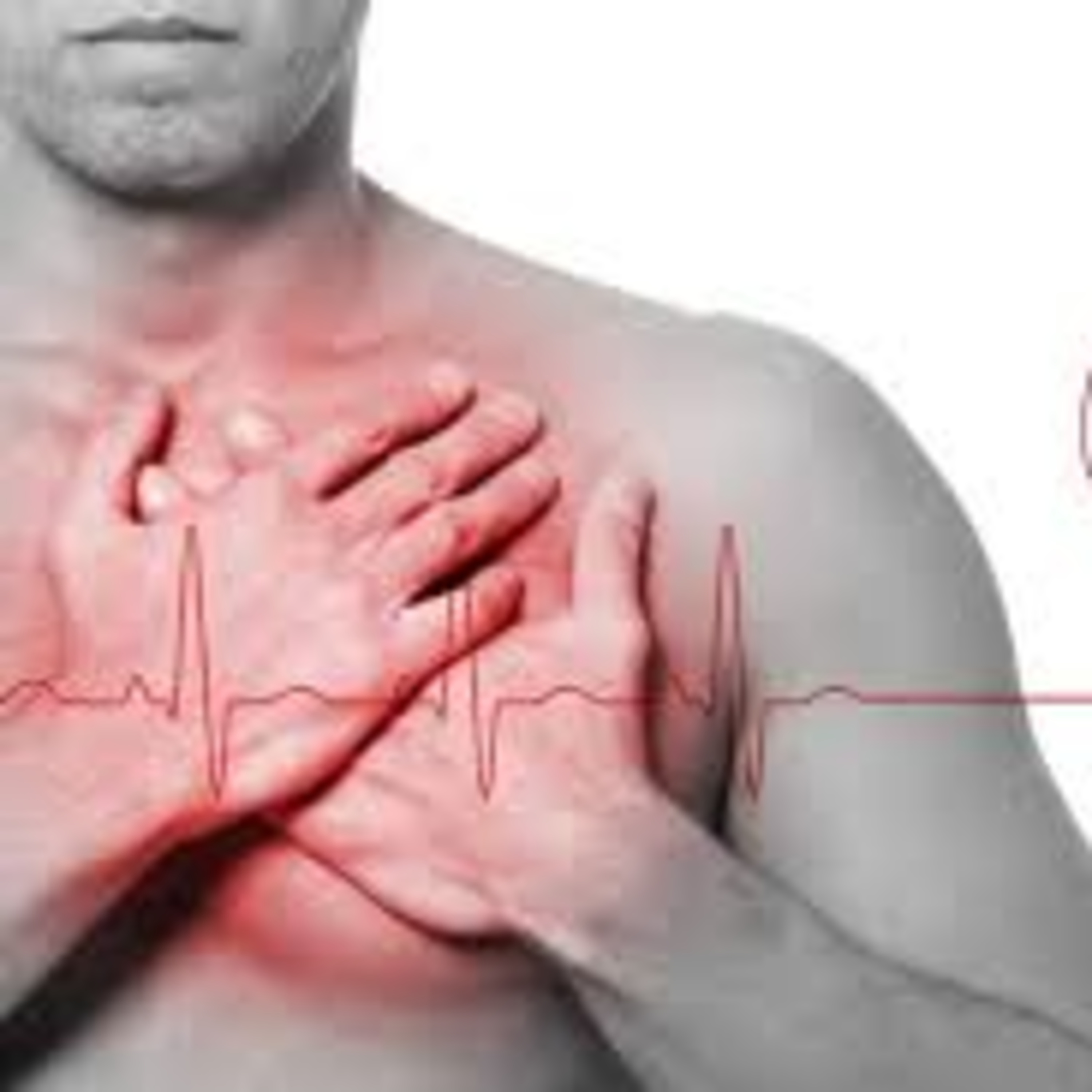 Parte 1 - Colesterol