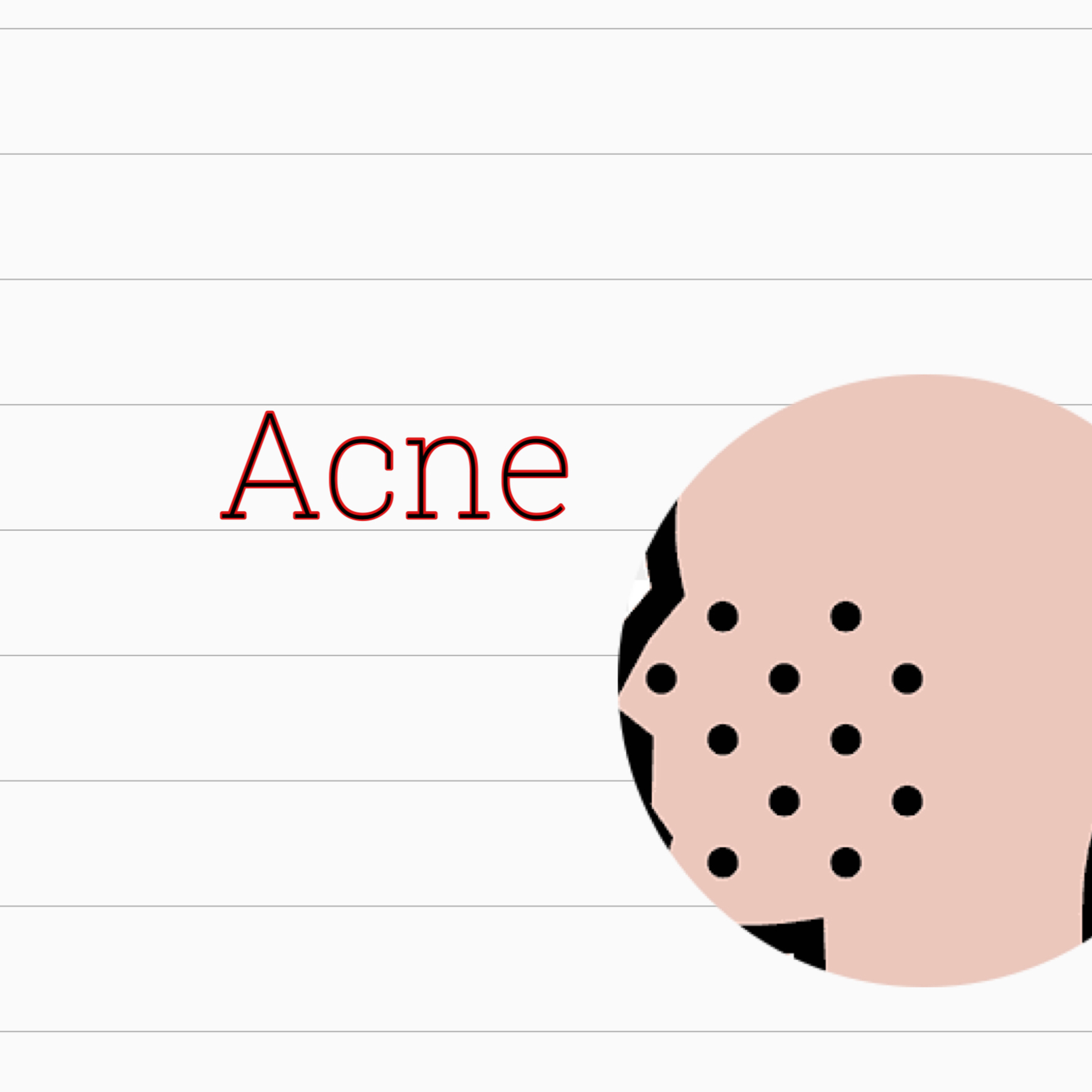 Acne doesn’t define who you are episode artwork