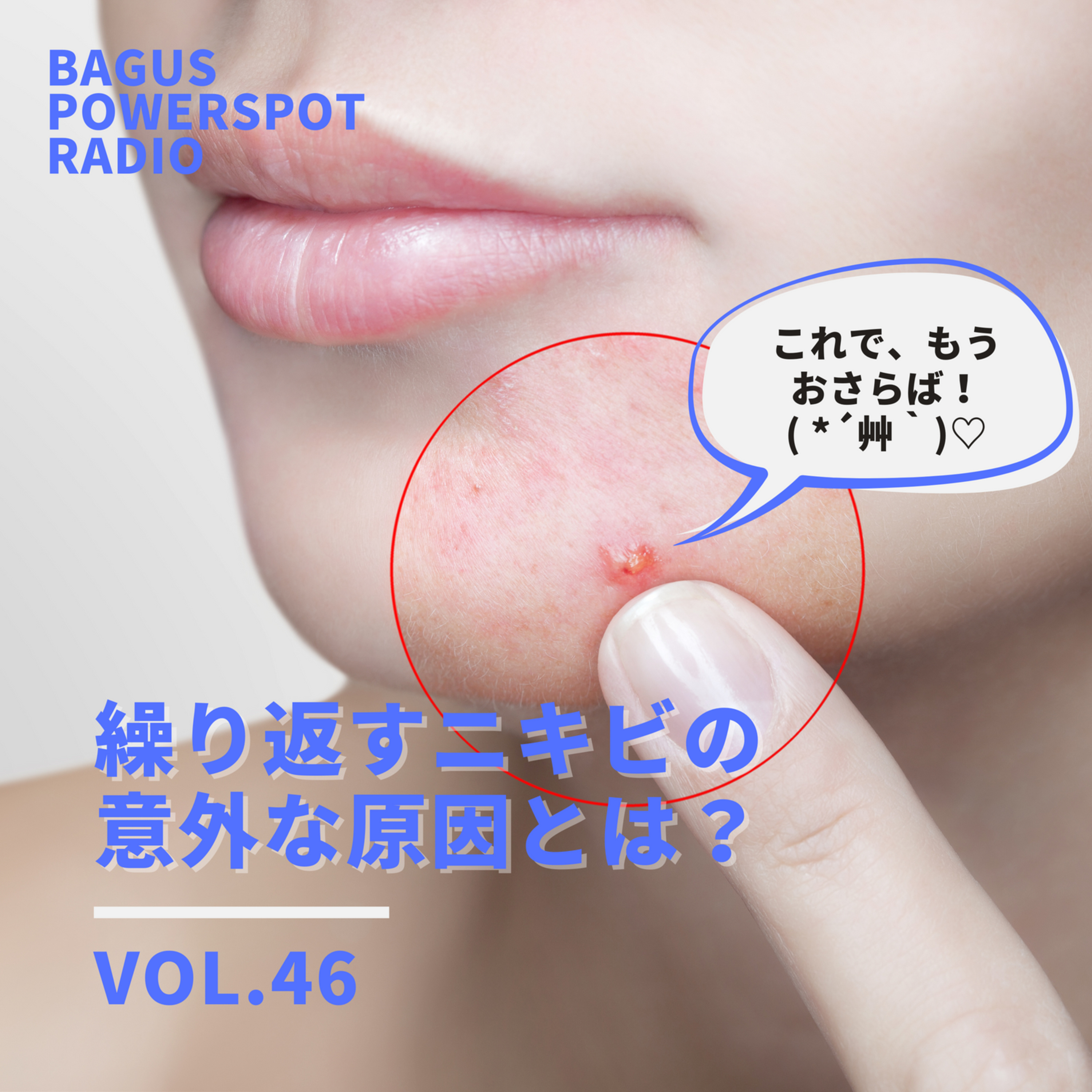 VOL.46　繰り返すニキビの意外な原因とは？ episode artwork