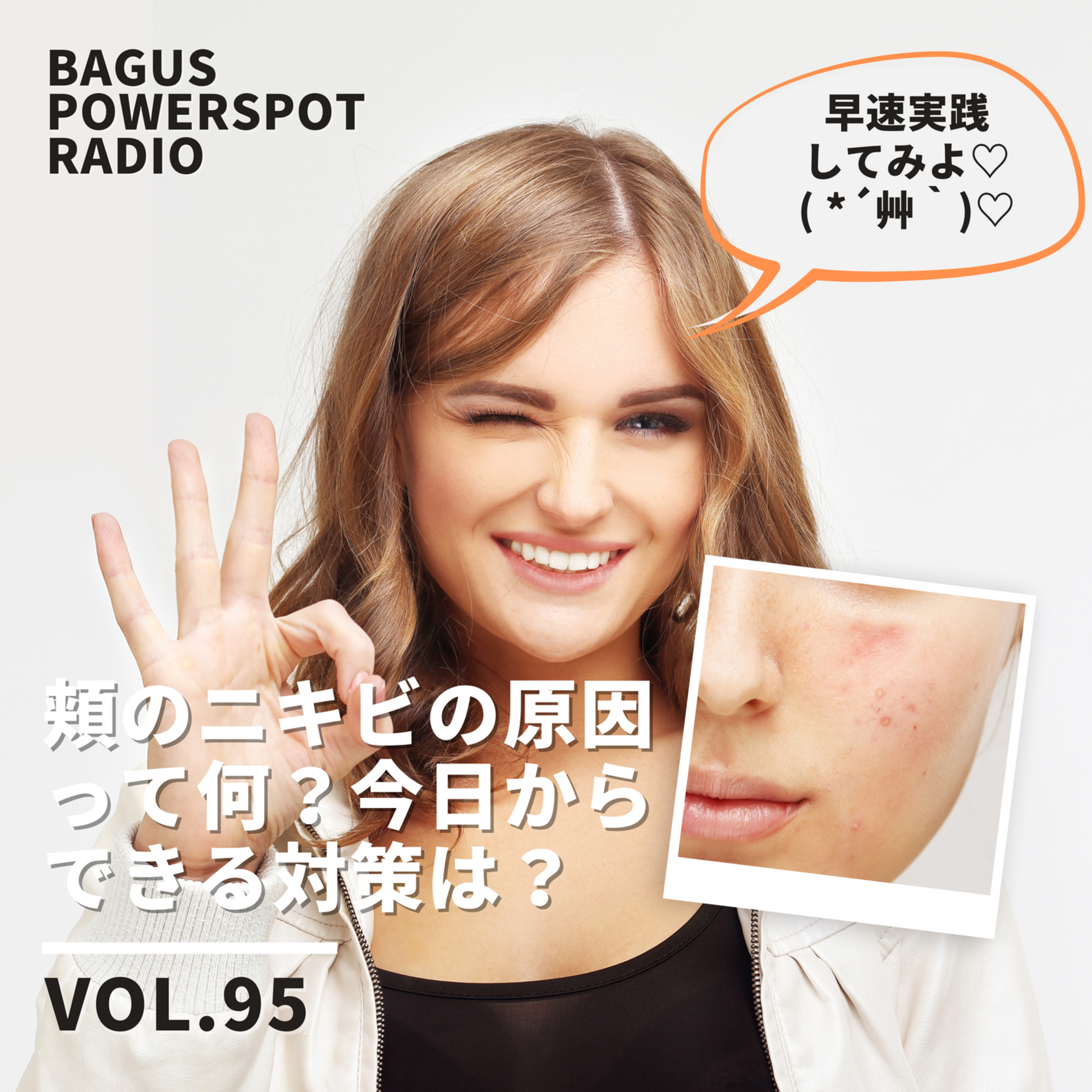 VOL.95 　頬に繰り返しできるニキビの原因って何？今日からできる対策は？ episode artwork