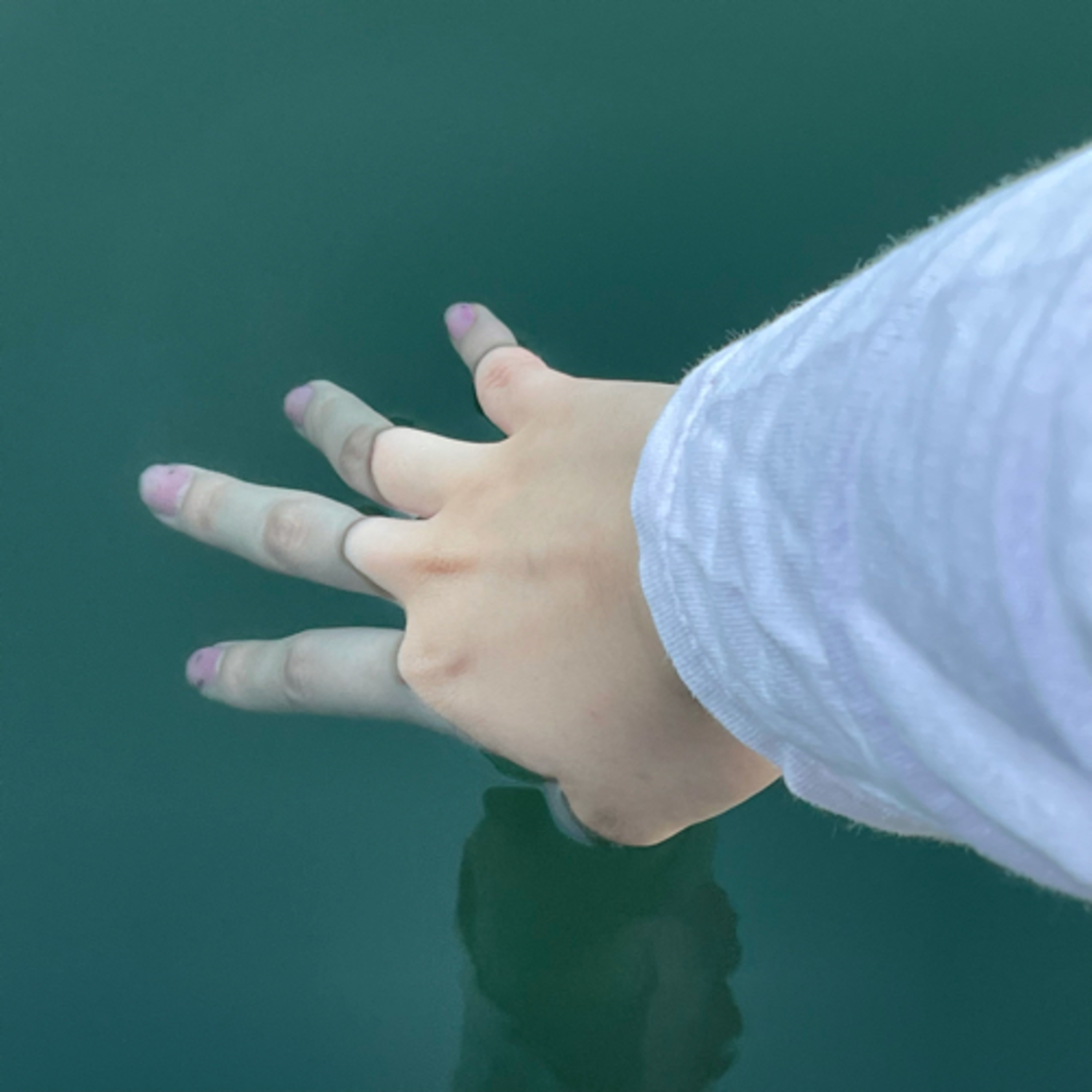 38🚣🏼‍♀️Help...私の体に空気が溜まり続ける🚣🏼‍♀️ episode artwork