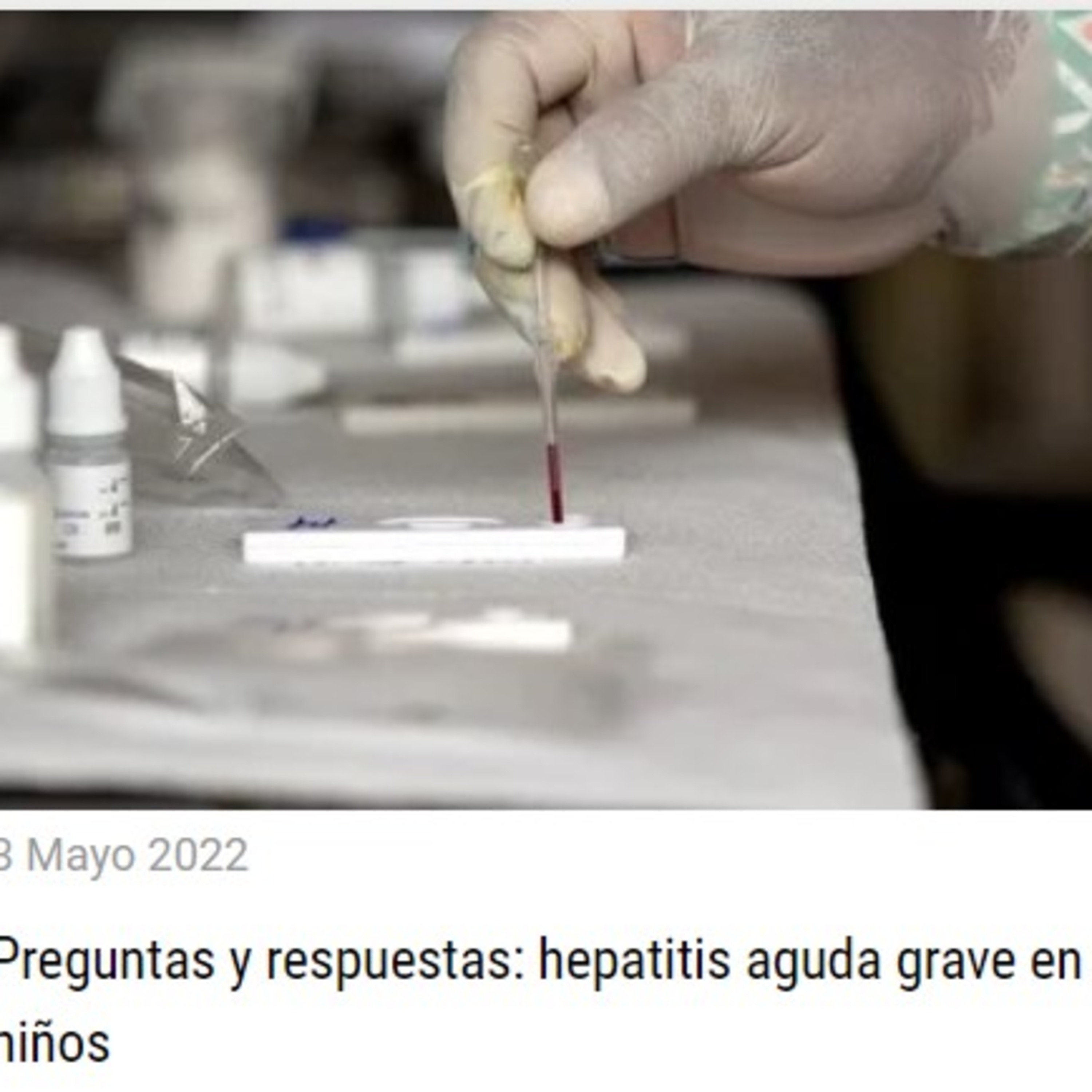 Hepatitis infantil ¿nueva amenaza? episode artwork