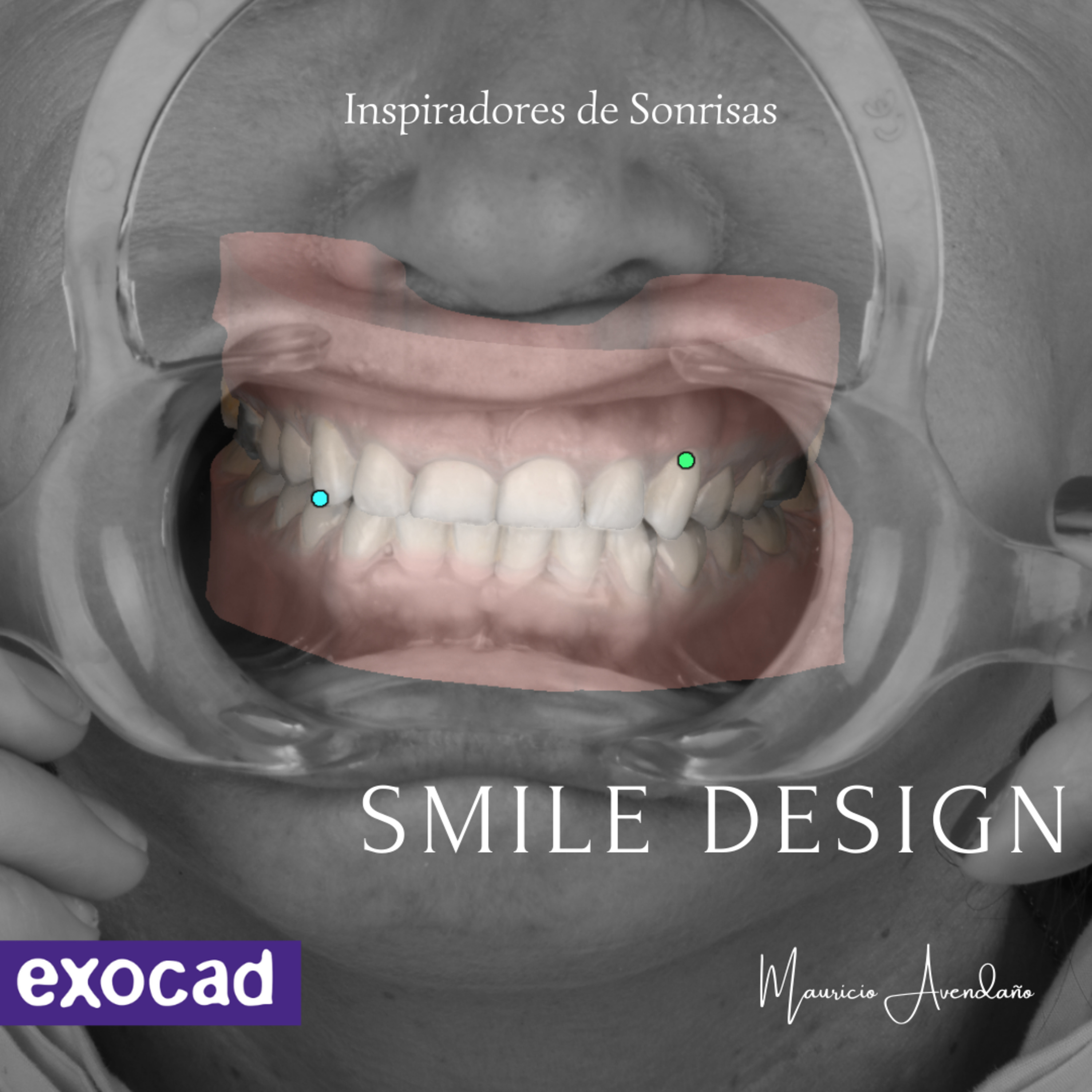 Odontología Digital con MAU
