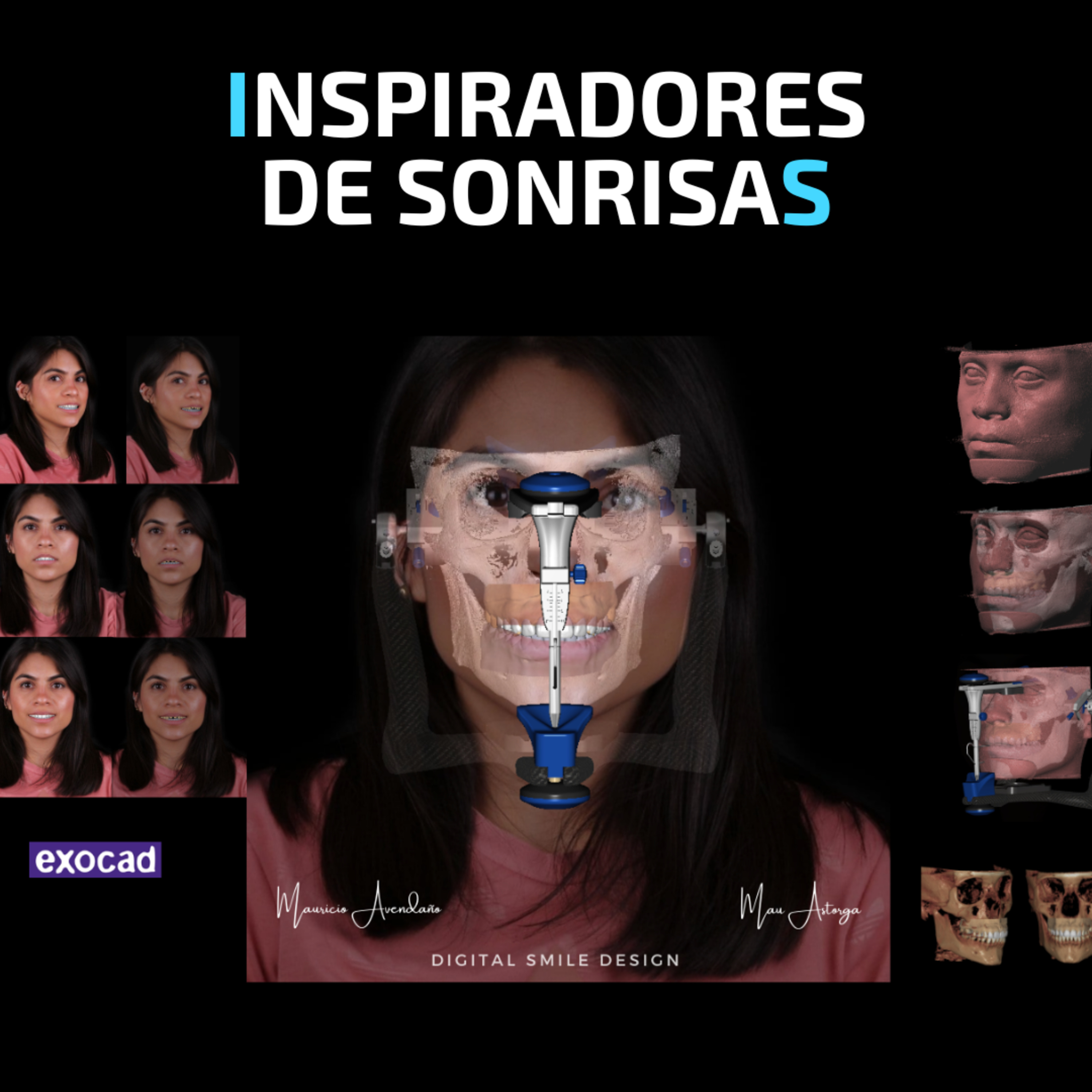 Odontología Digital con MAU