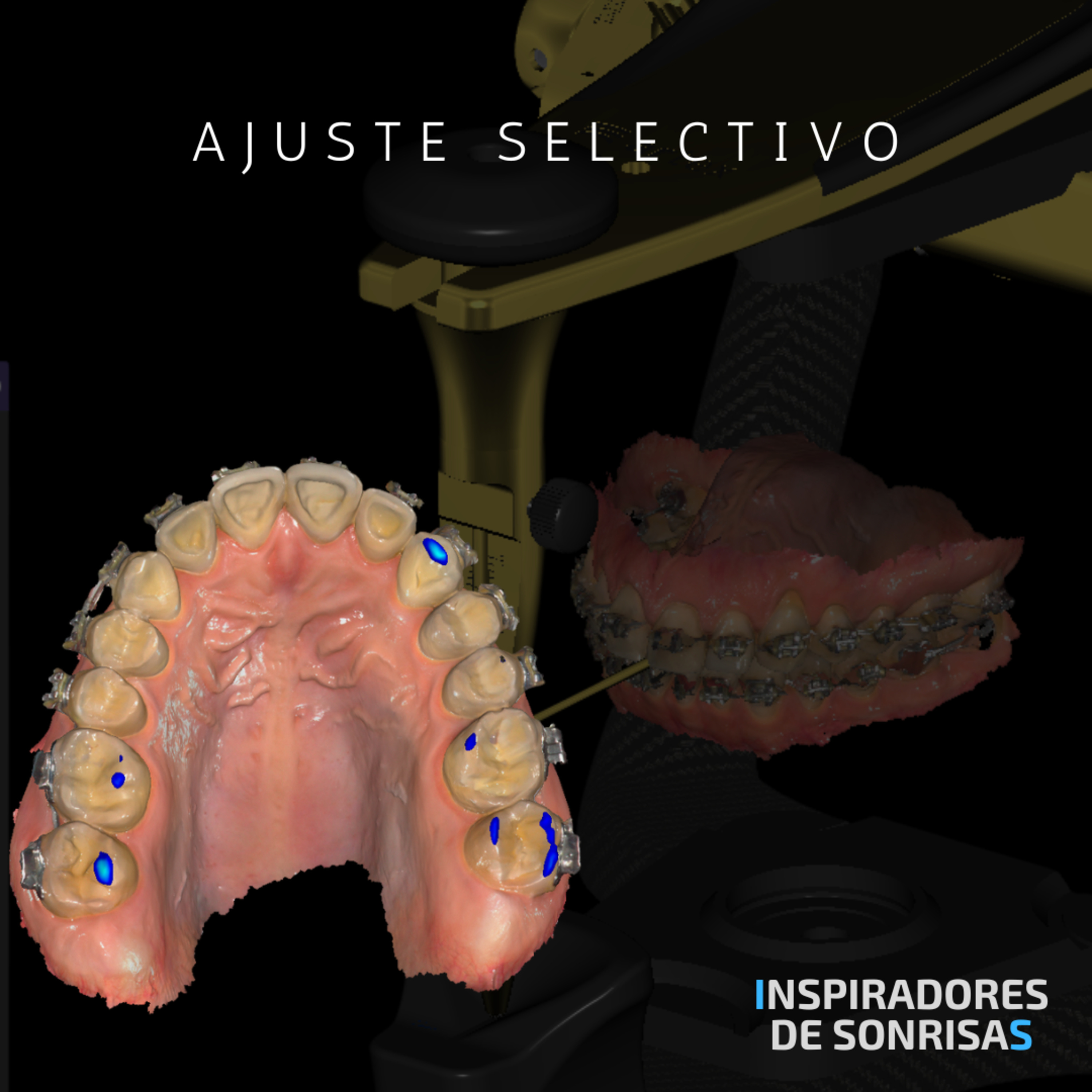 Odontología Digital con MAU