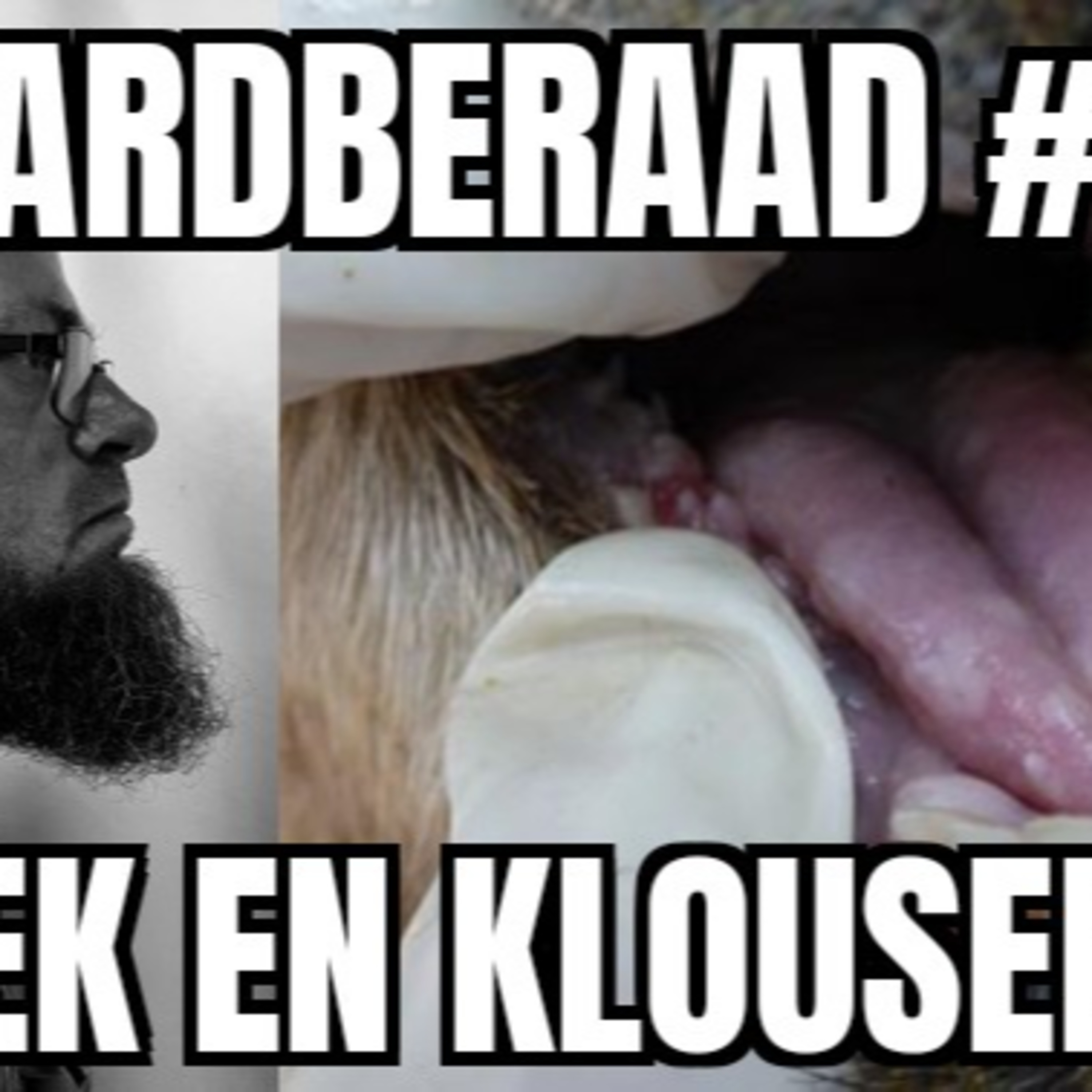 Baardberaad