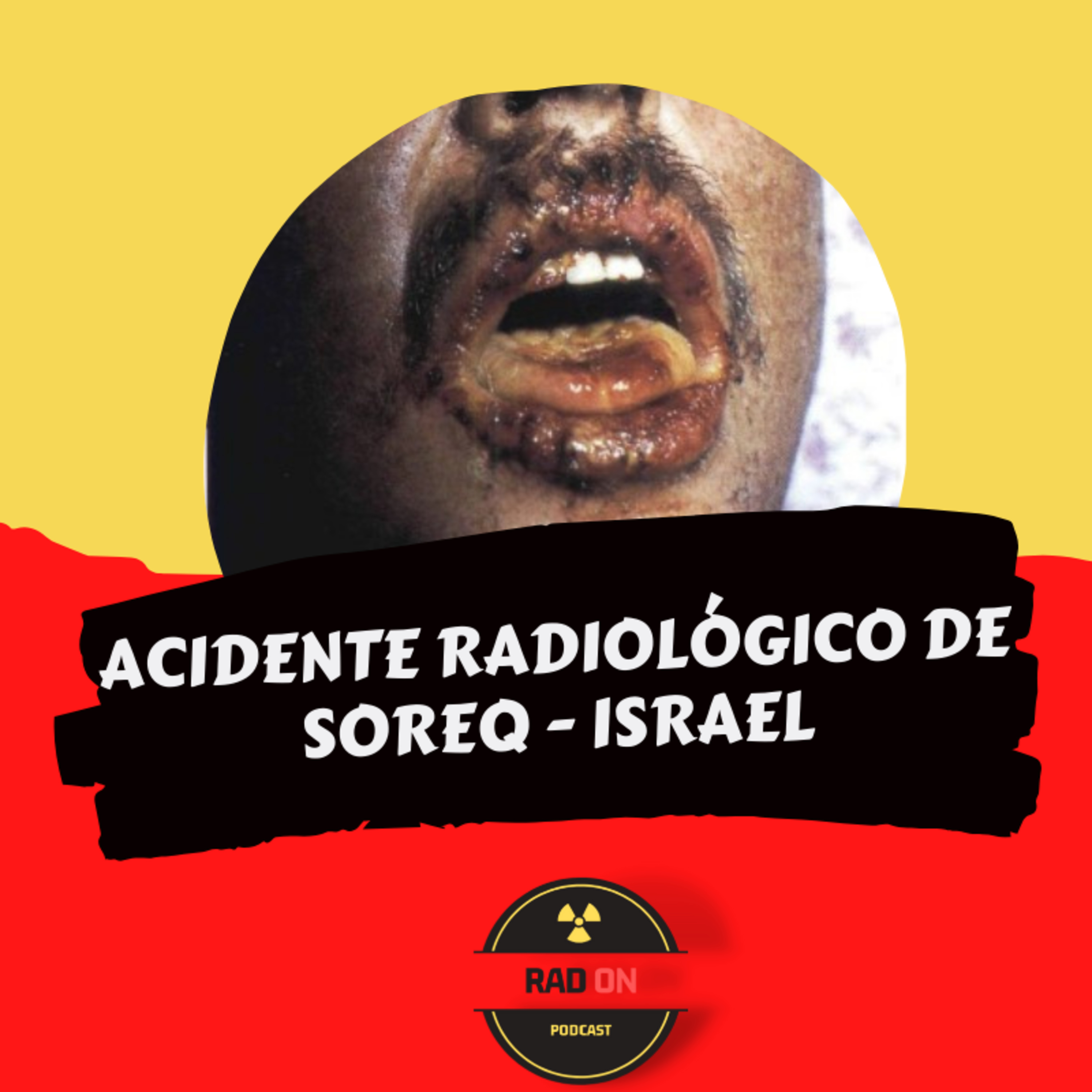 Radiação para Leigos