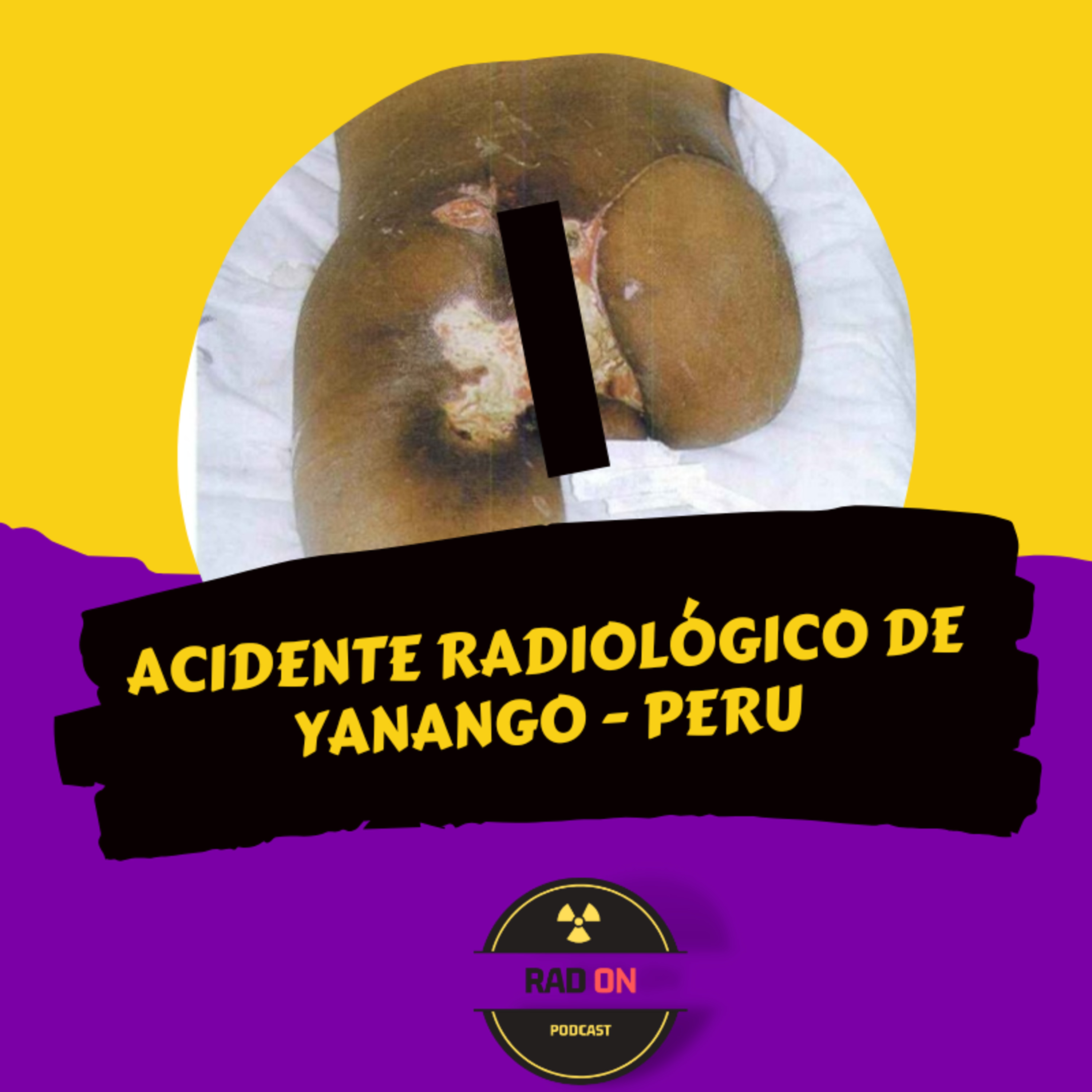 Radiação para Leigos