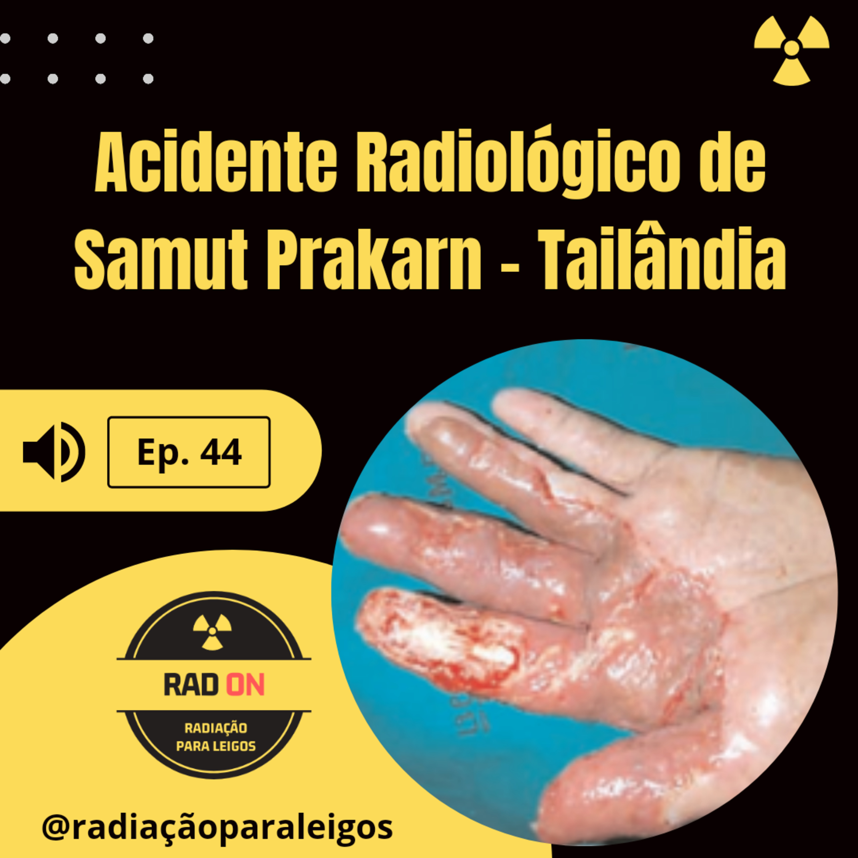 Radiação para Leigos
