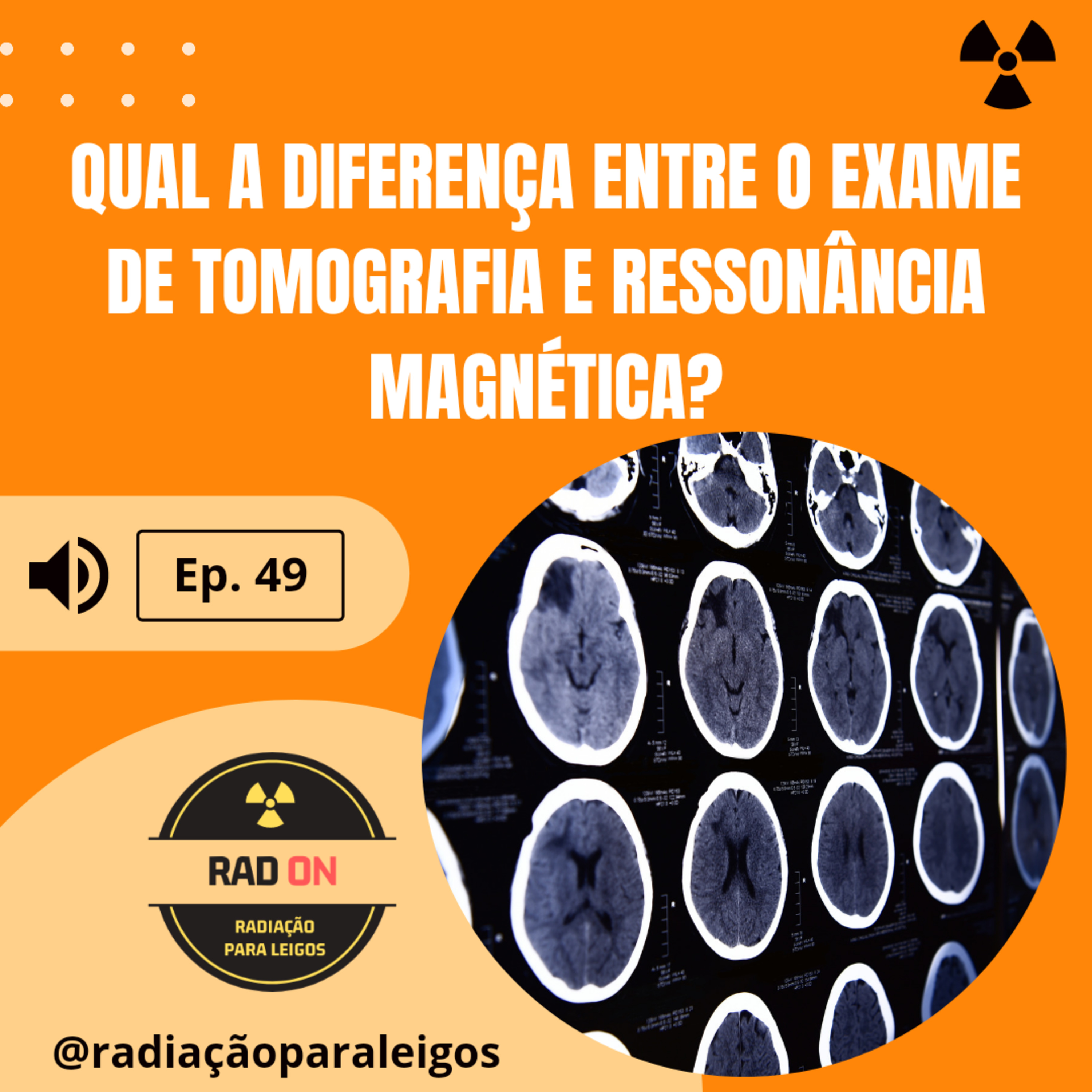 Radiação para Leigos