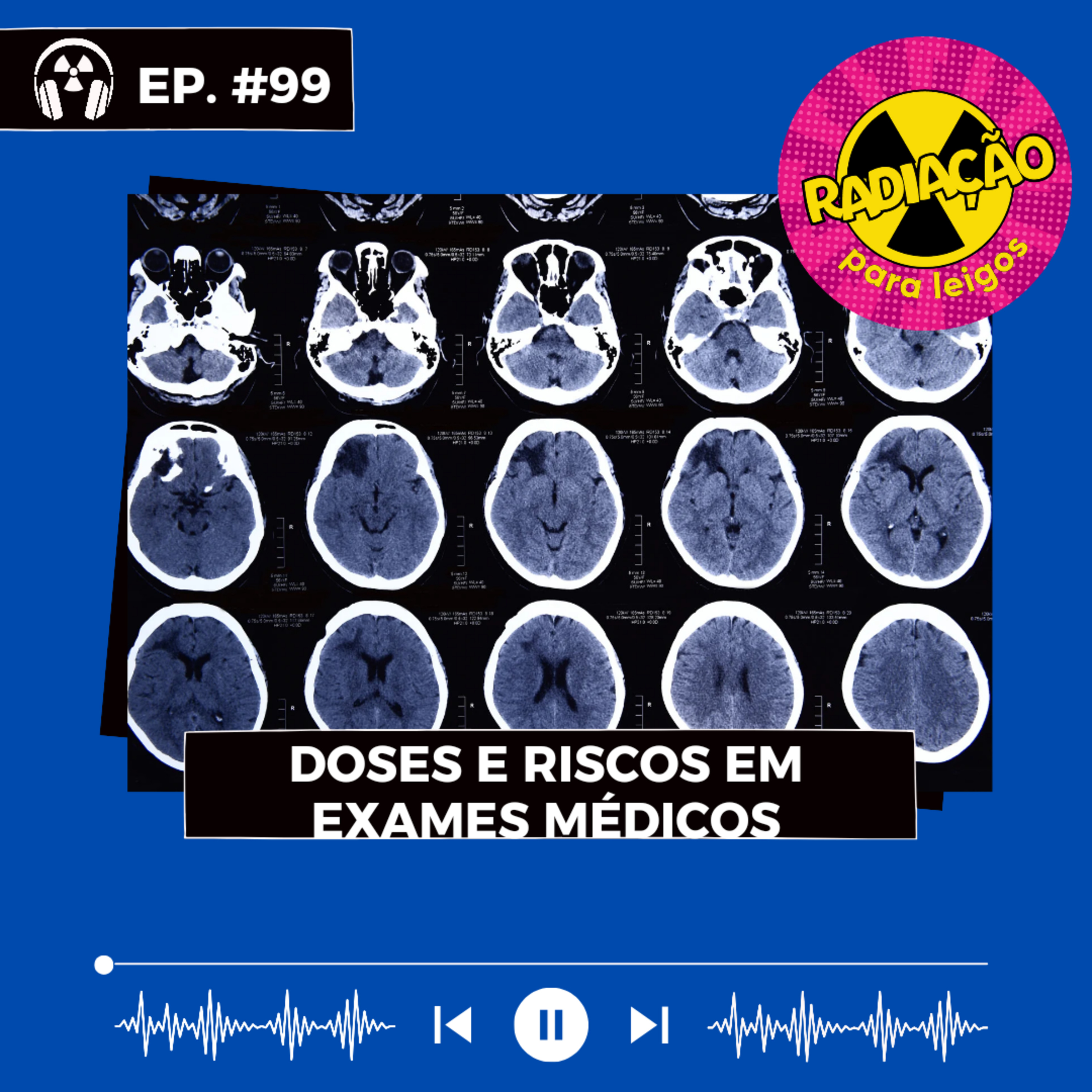 RadOn#99 - Doses e Riscos em Exames Médicos – Radiação para Leigos ...
