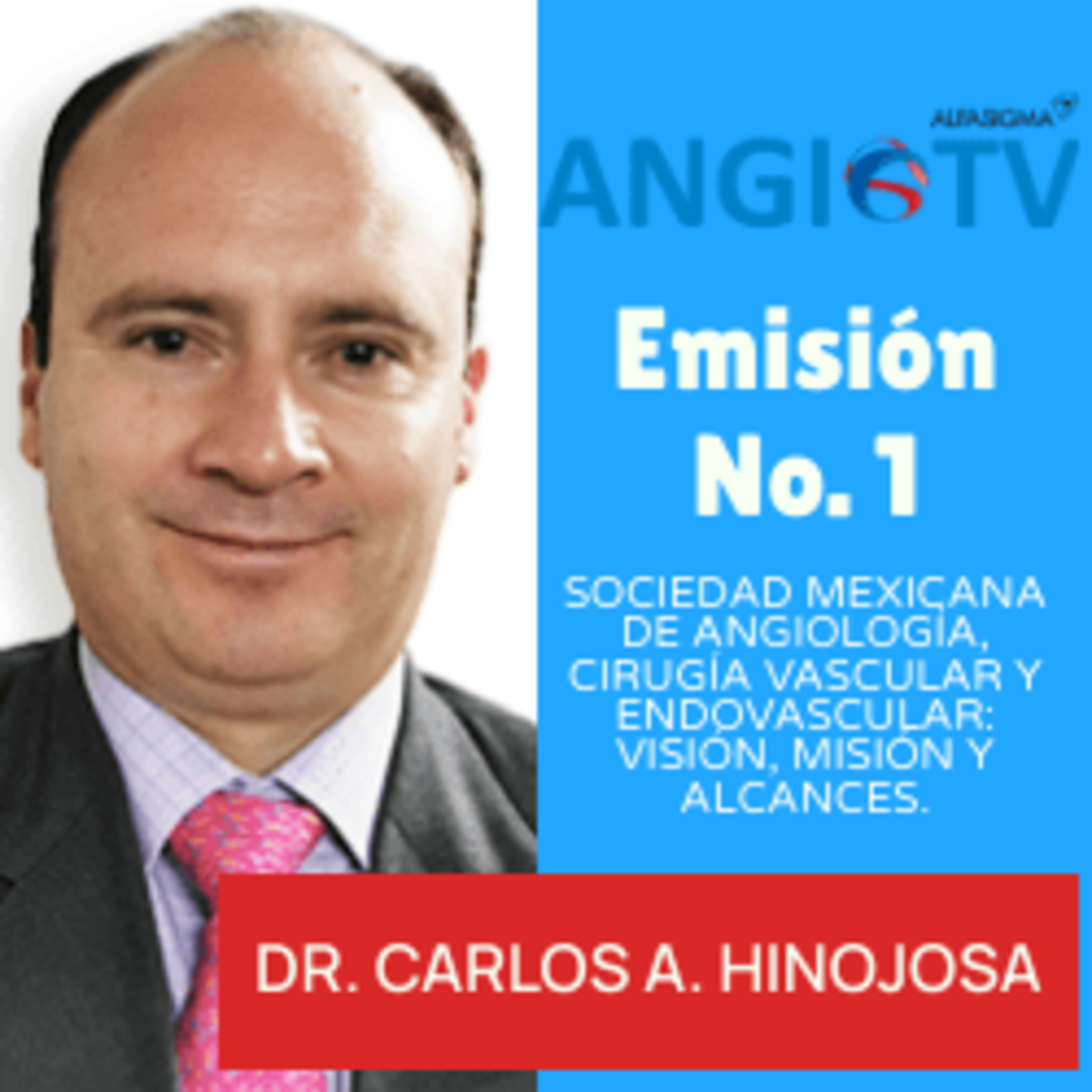 ANGIO TV
