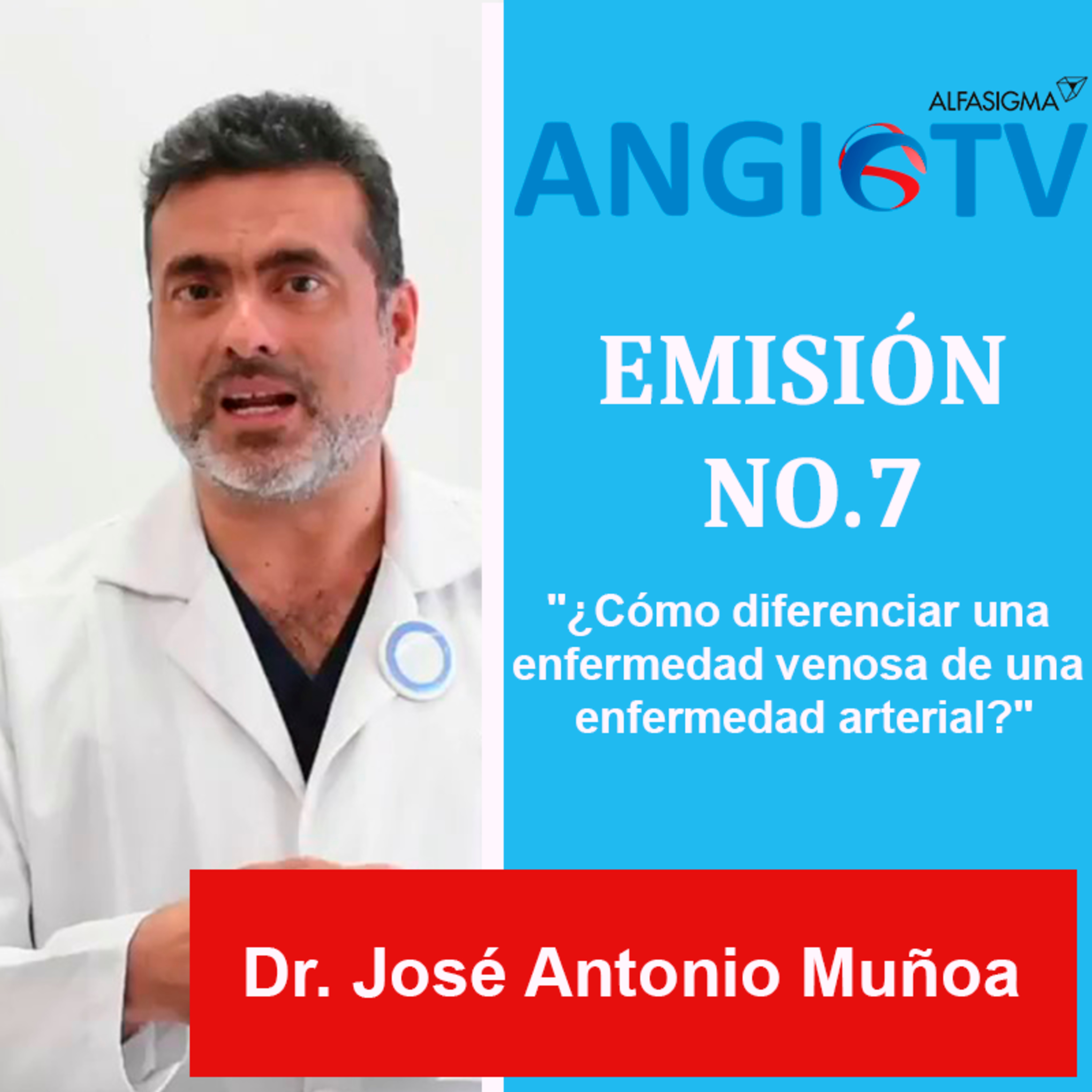 ANGIO TV