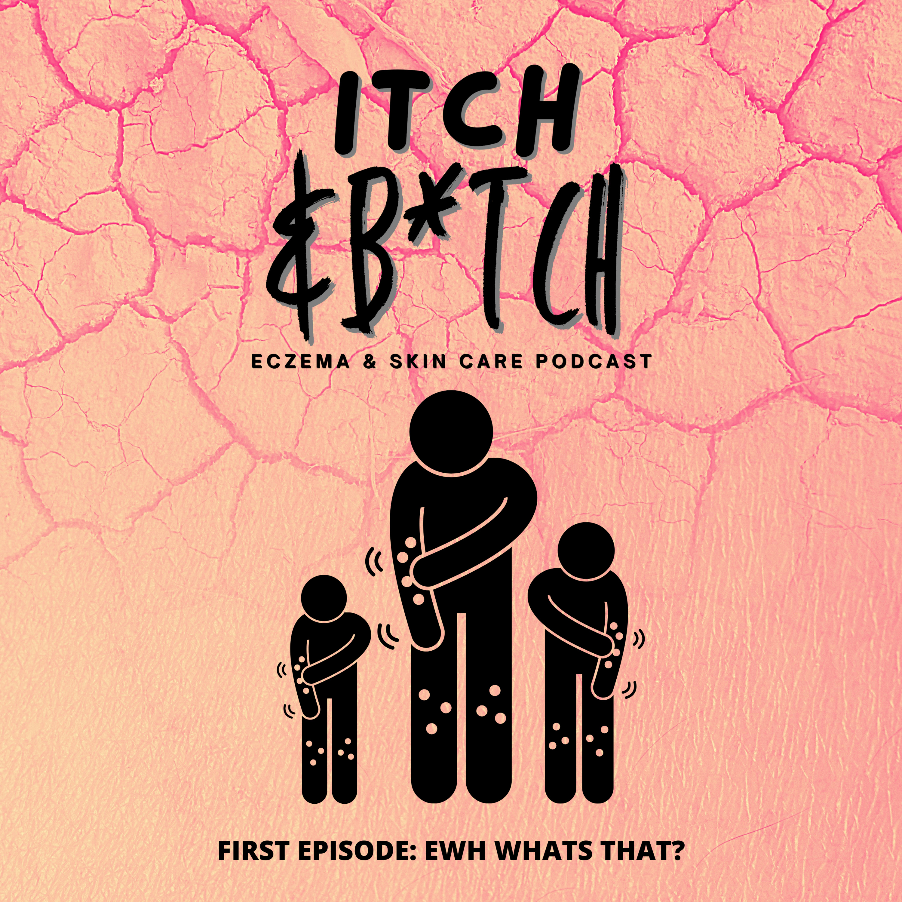 CHILDHOOD ECZEMA STORIES: 'EWH whats that?'