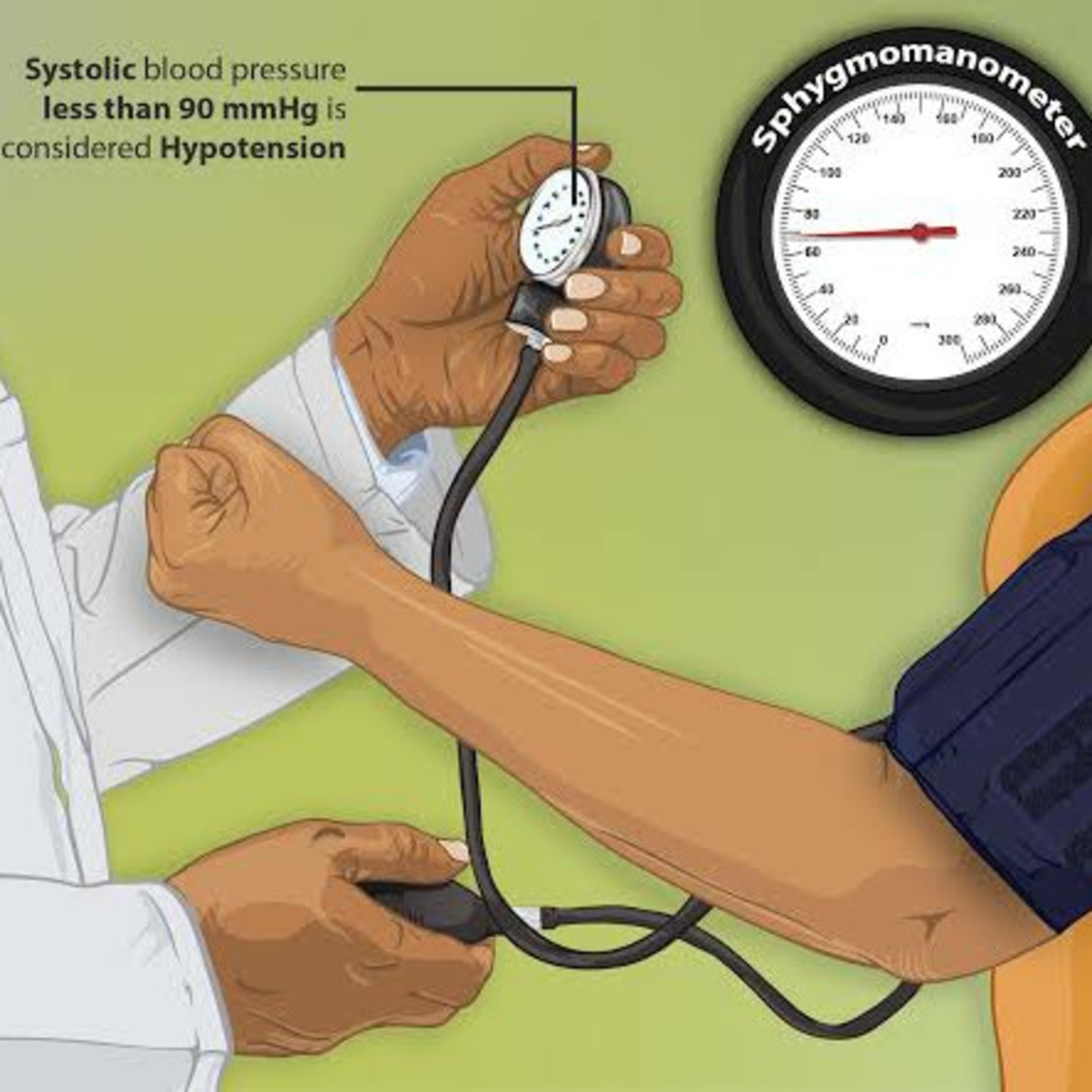 Mx of Acute contrast reaction (hypotension) Episode3