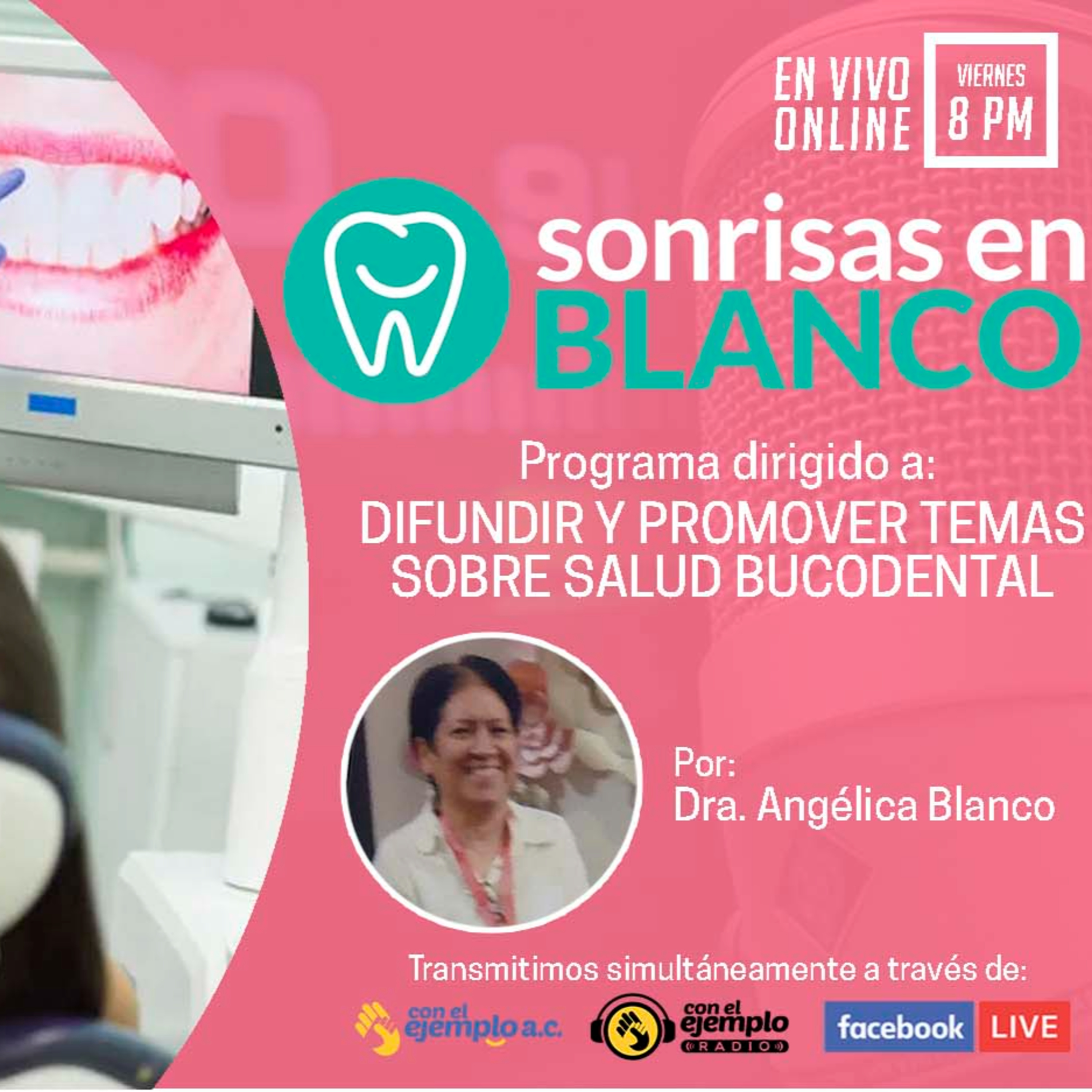 Con el Ejemplo Radio