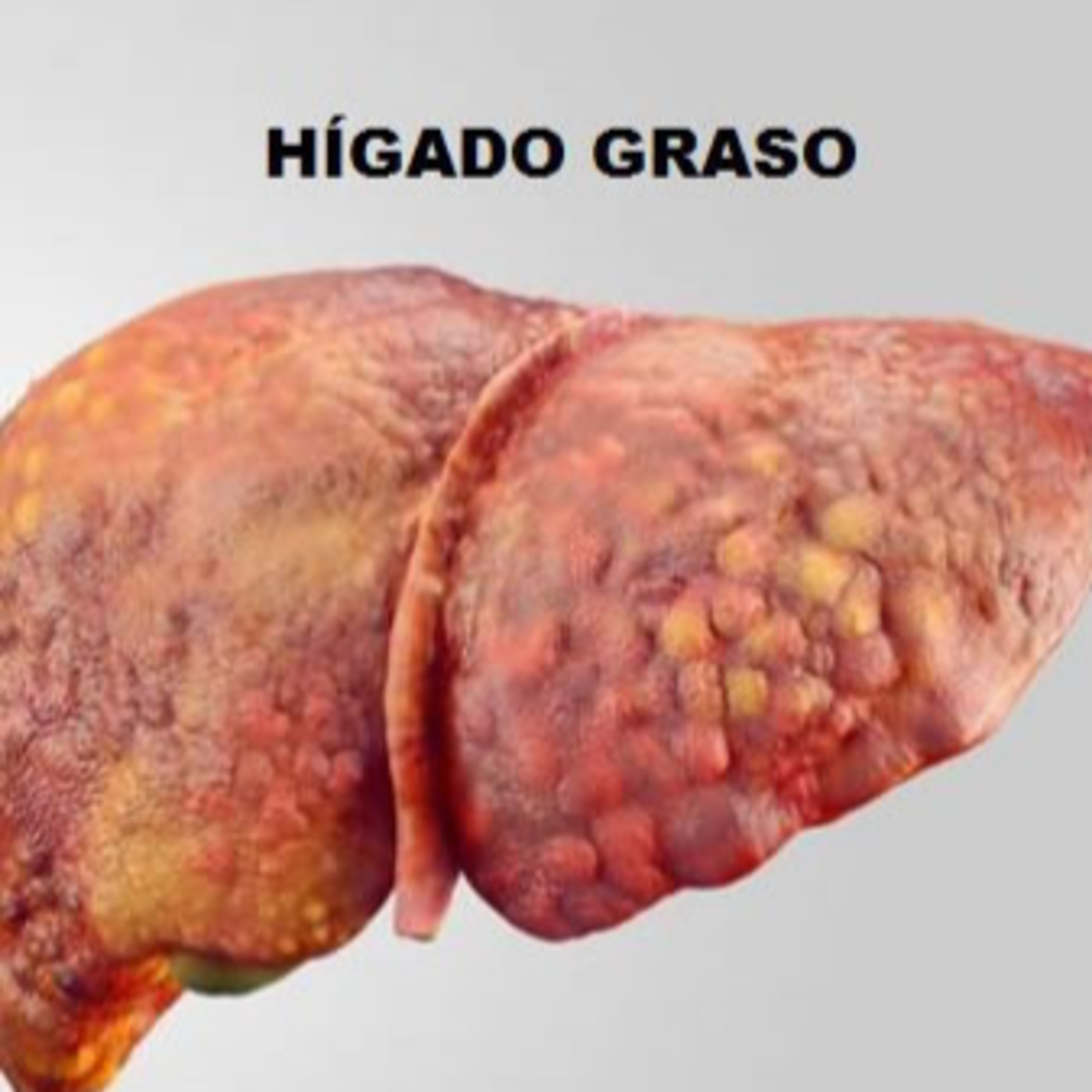 Nutrilízate