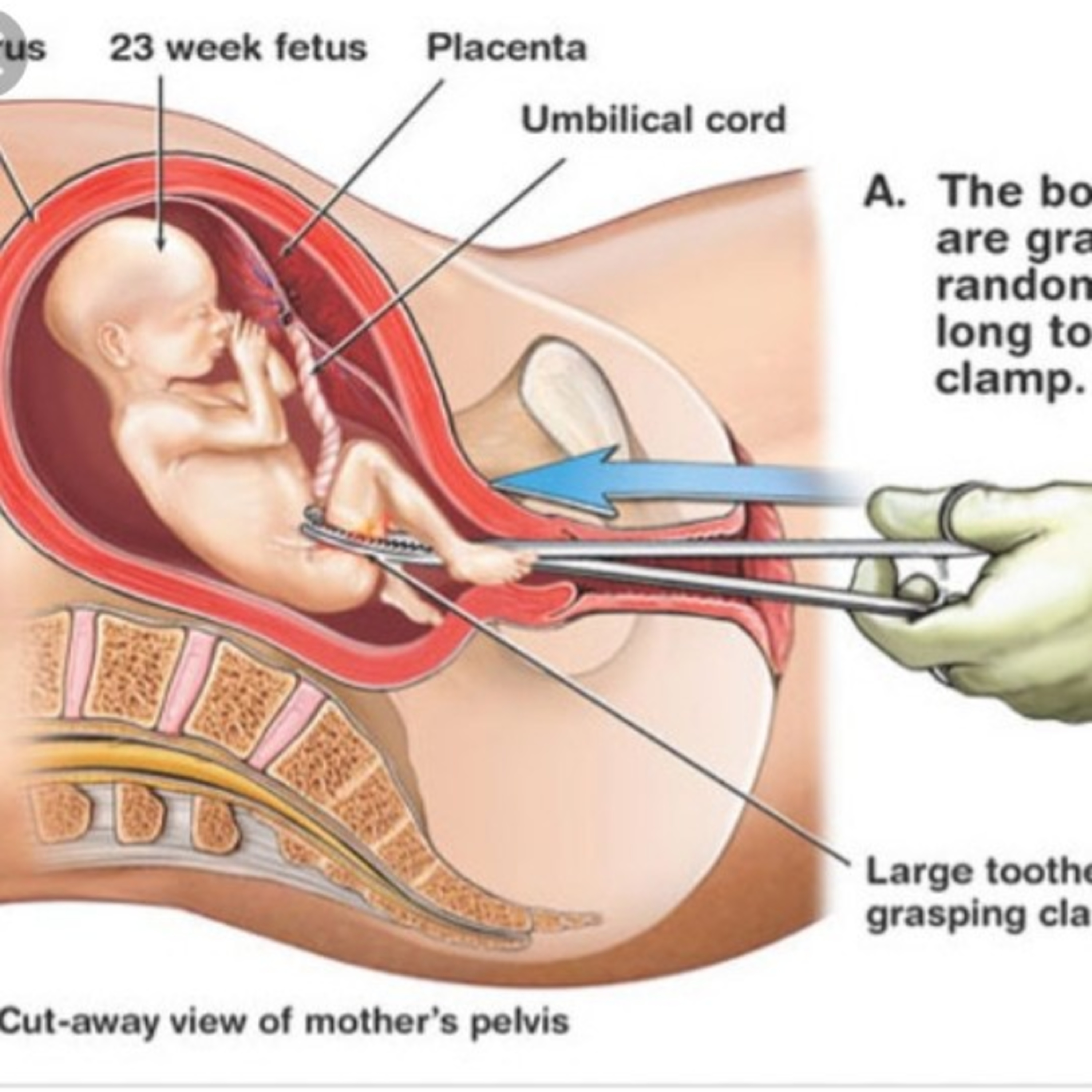 Episode 41 Abortianna Laws episode artwork