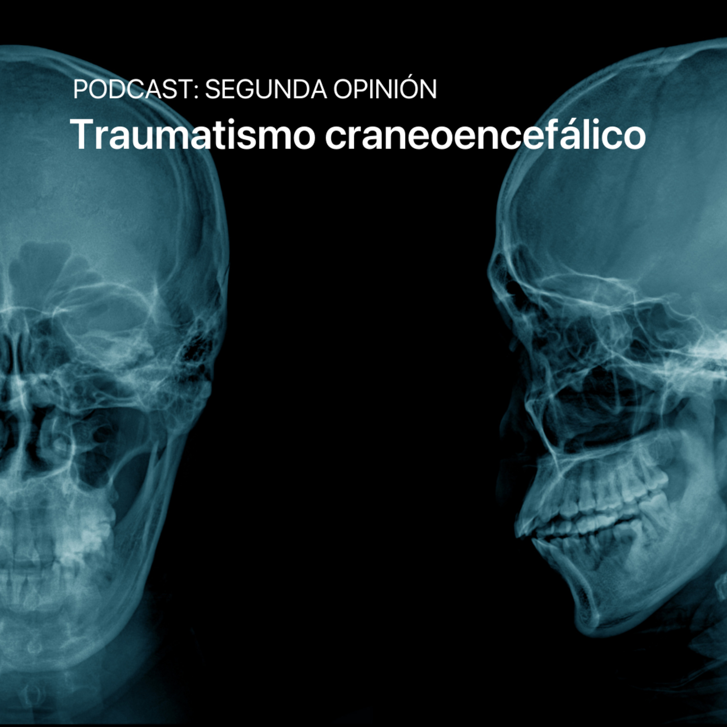 Segunda Opinión