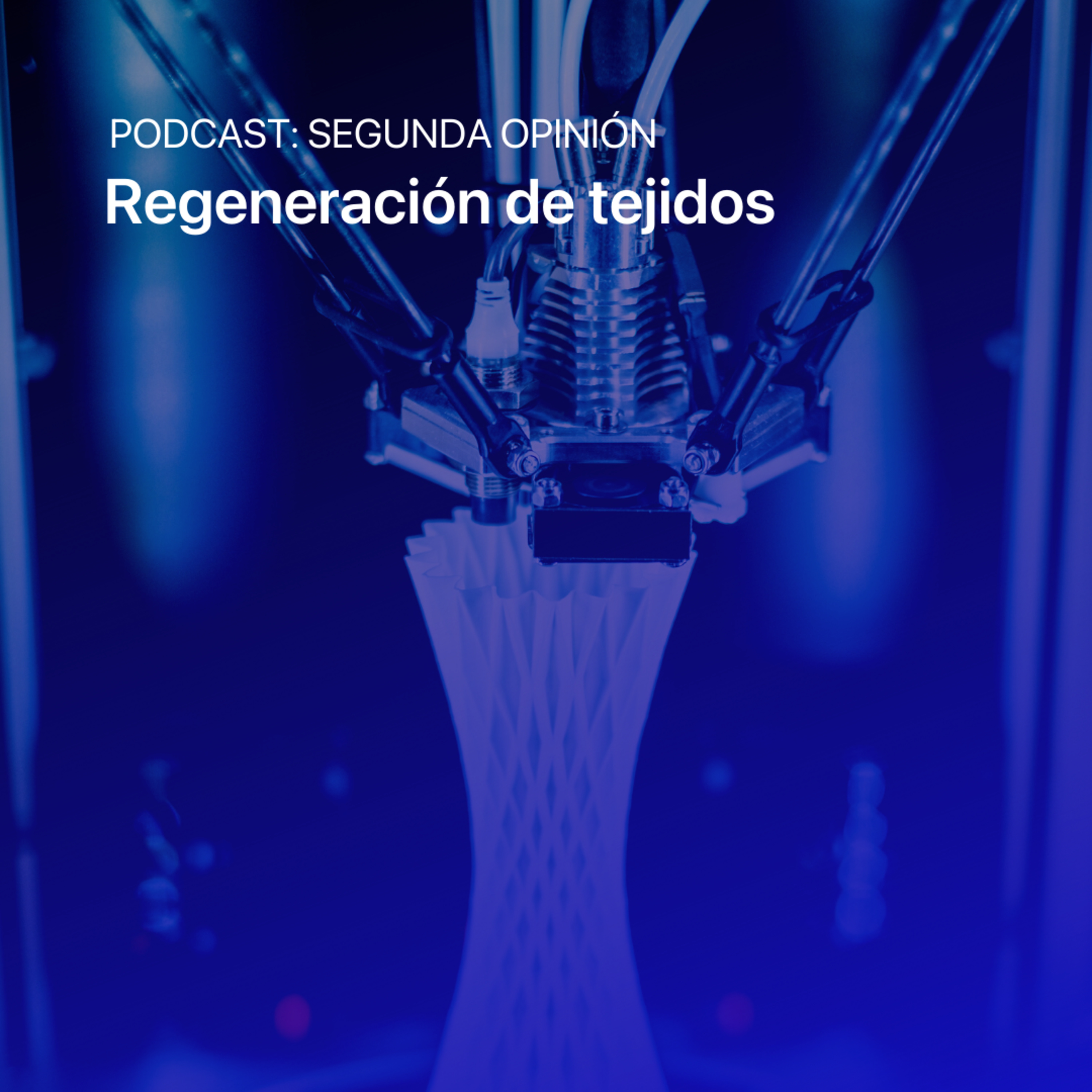 Segunda Opinión
